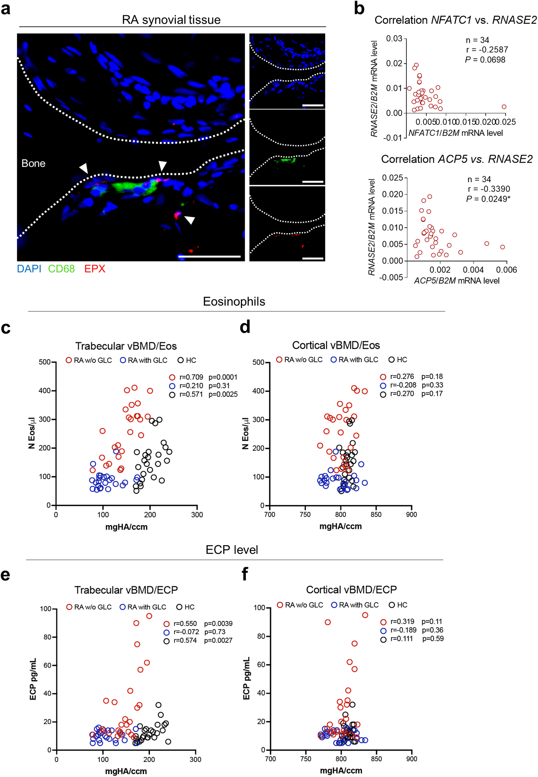Fig. 8: Eosinophils and eosinophil cationic protein levels are correlated with bone mass in humans.