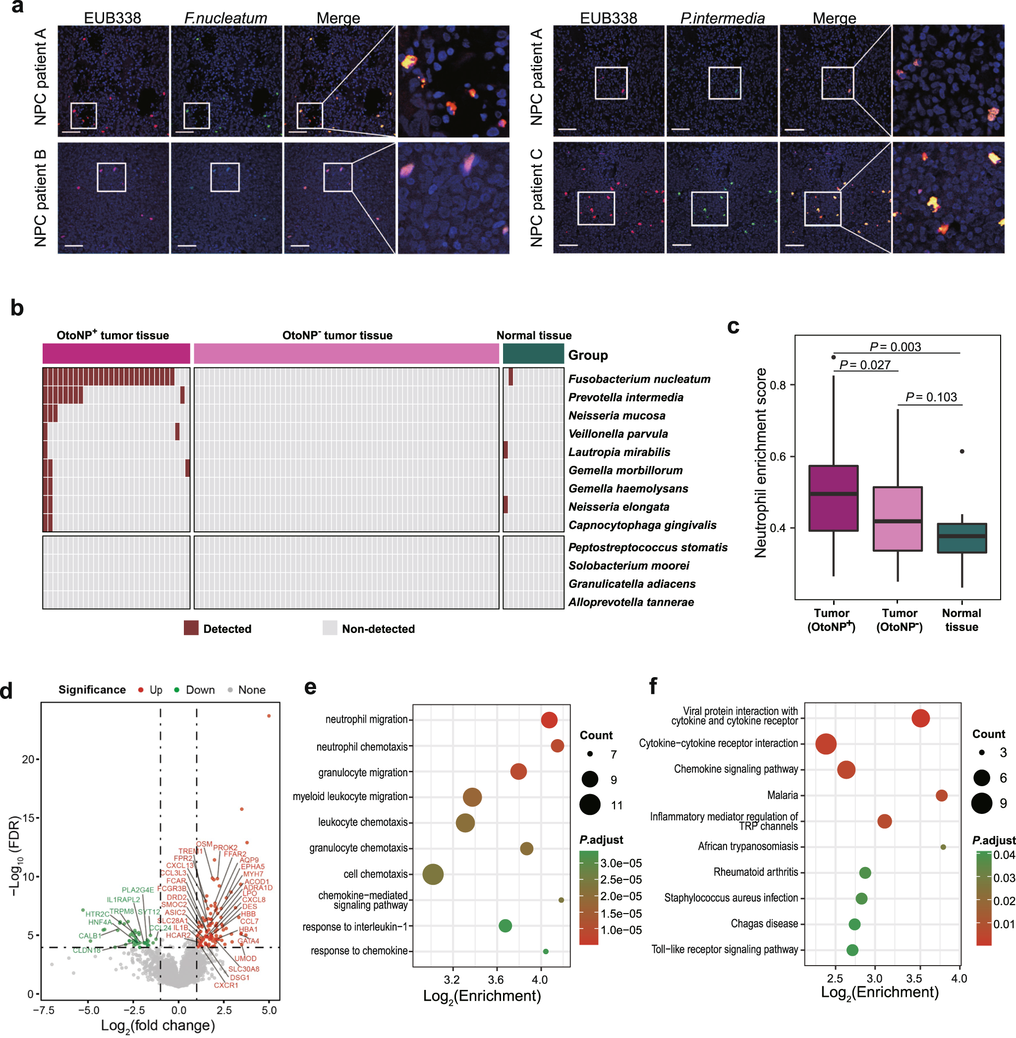 Fig. 4: Oral translocated microbes infiltrated the tumor and affected the tumor microenvironment.