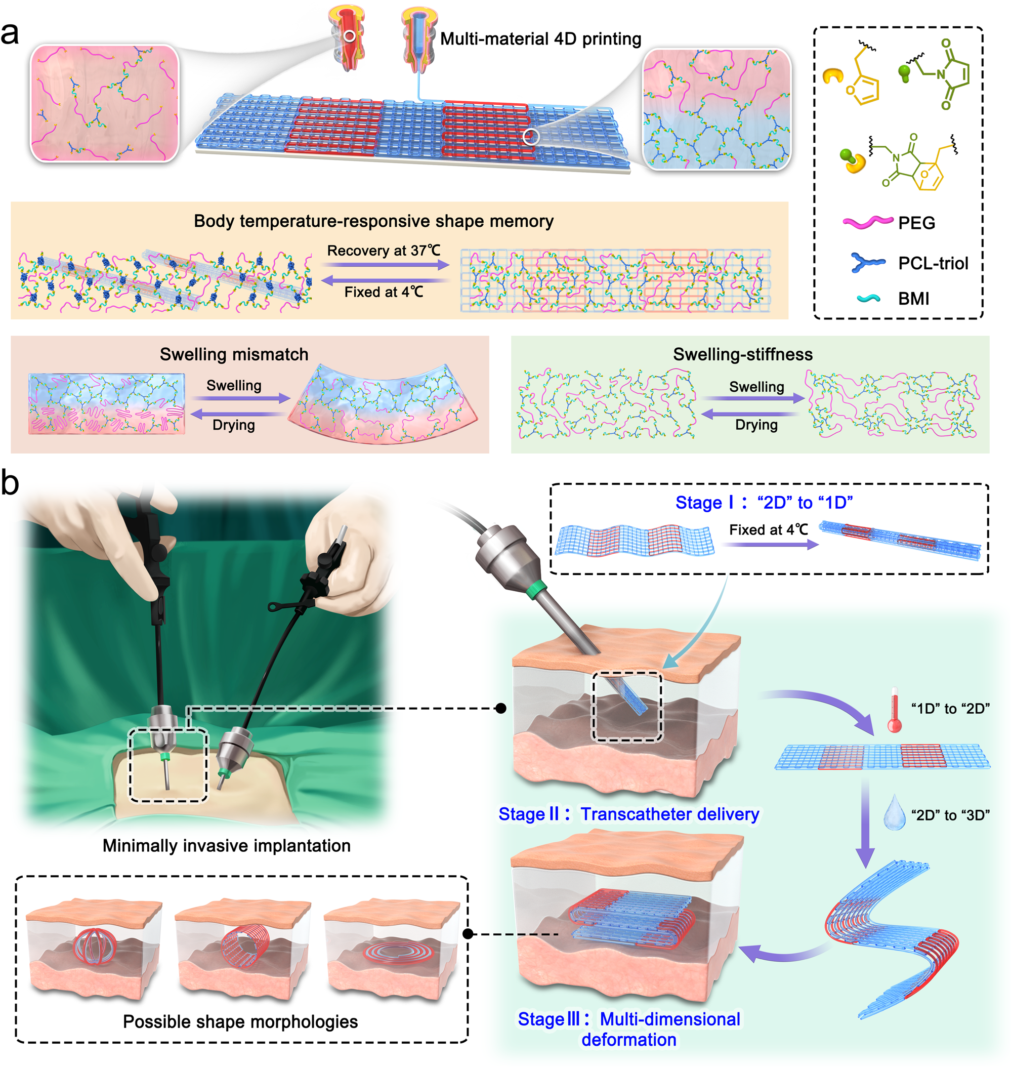 4D printed hydrogel scaffold with swelling-stiffening properties and programmable deformation for minimally invasive implantation | Nature Communications 4d-printed-hydrogel-scaffold-with-swelling-stiffening-properties-and-programmable-deformation-for-minimally-invasive-implantation-nature-communications