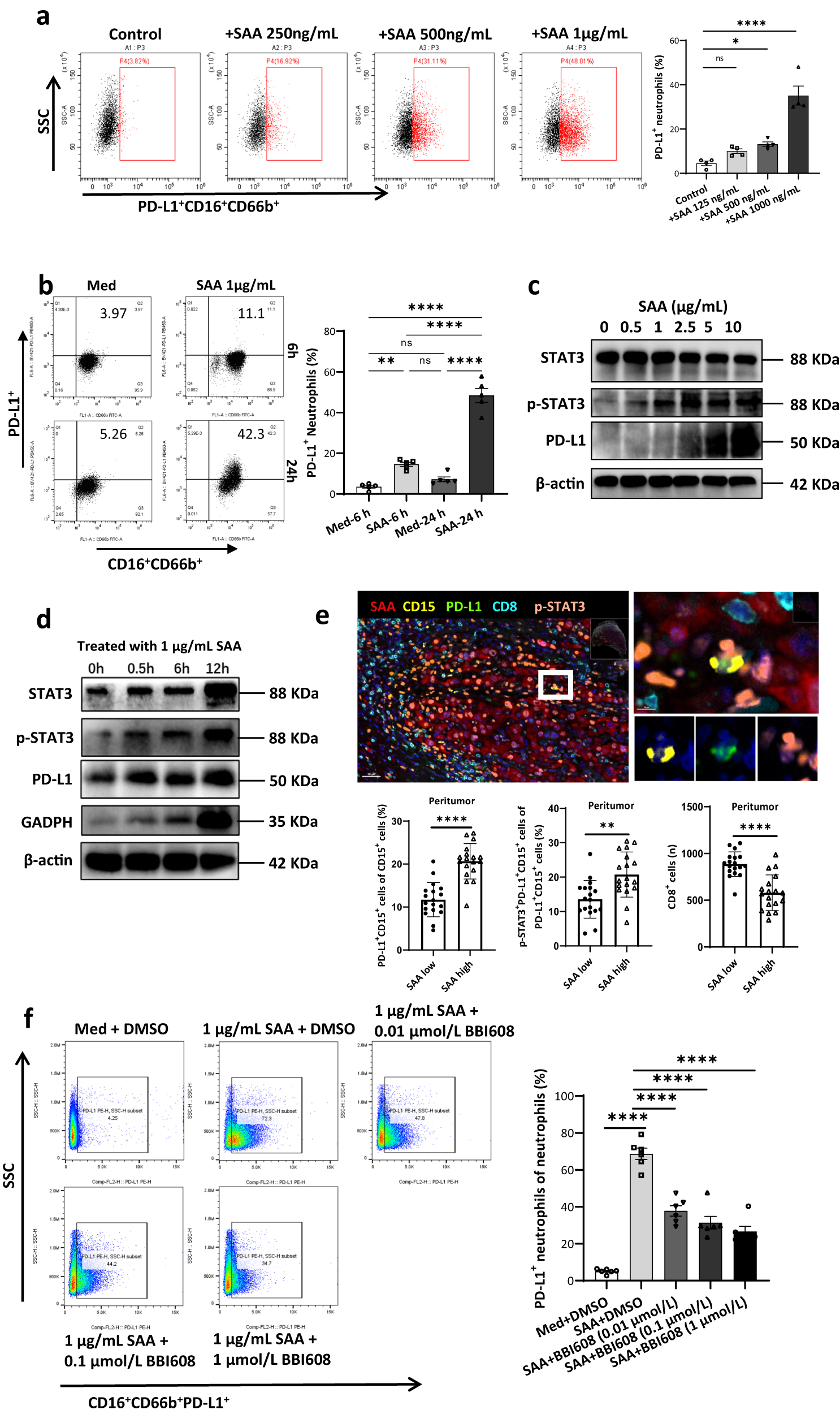 Fig. 3: The relationship of local SAA, nuclear p-STAT3, and PD-L1+ neutrophils.