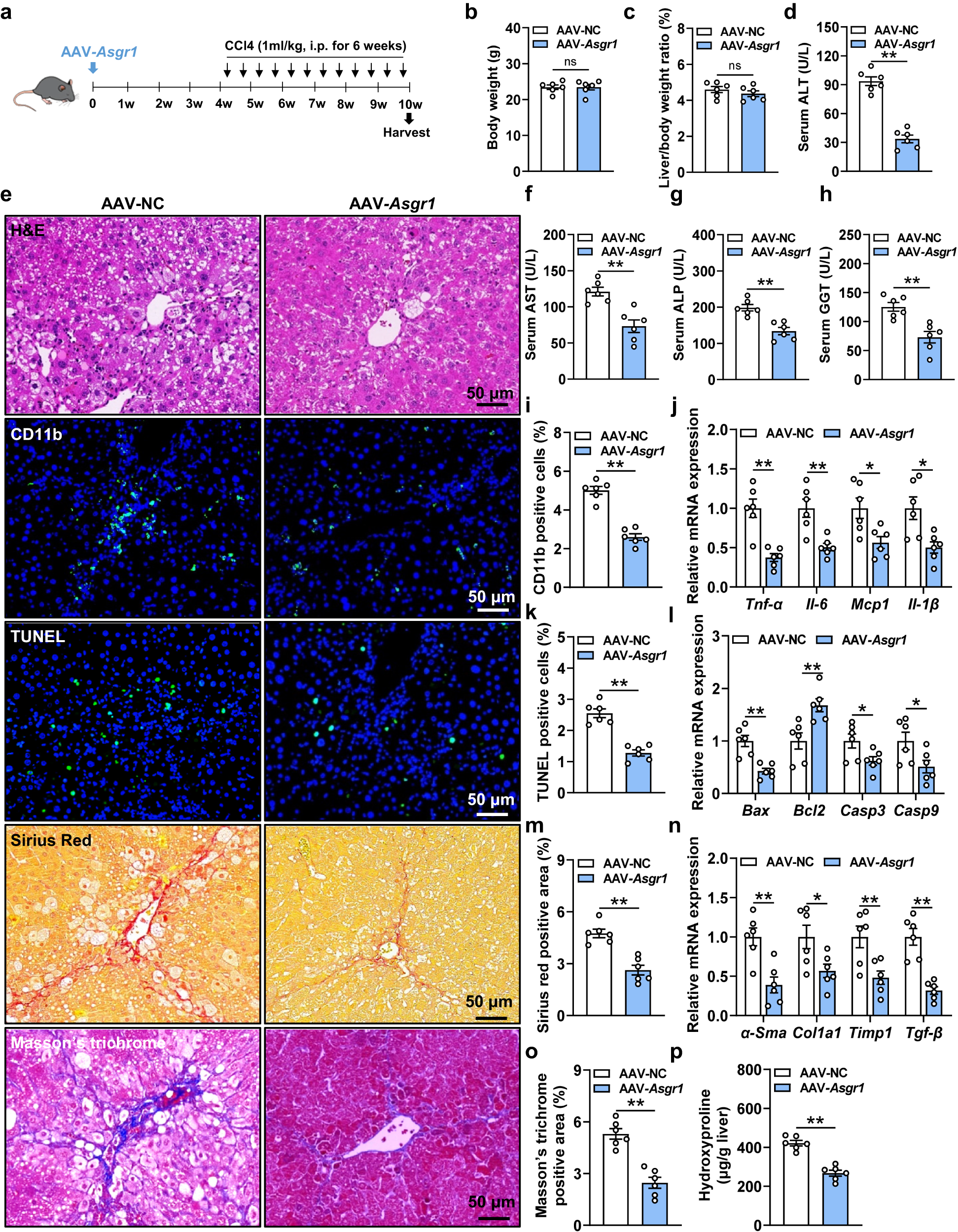 Fig. 3: Hepatic overexpression of Asgr1 ameliorates CCl4-induced chronic liver injury.
