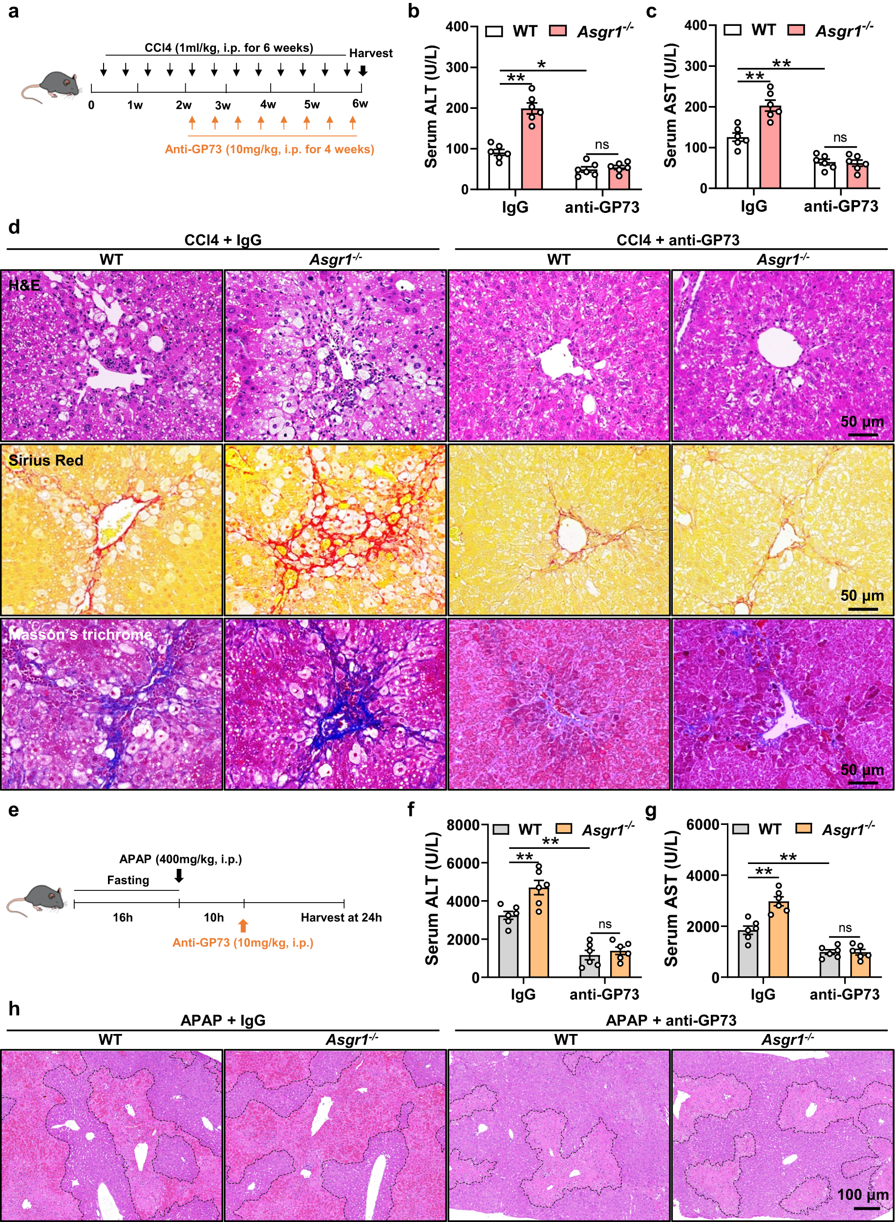 Fig. 7: Neutralization of GP73 attenuates ASGR1 deficiency-induced liver injury.