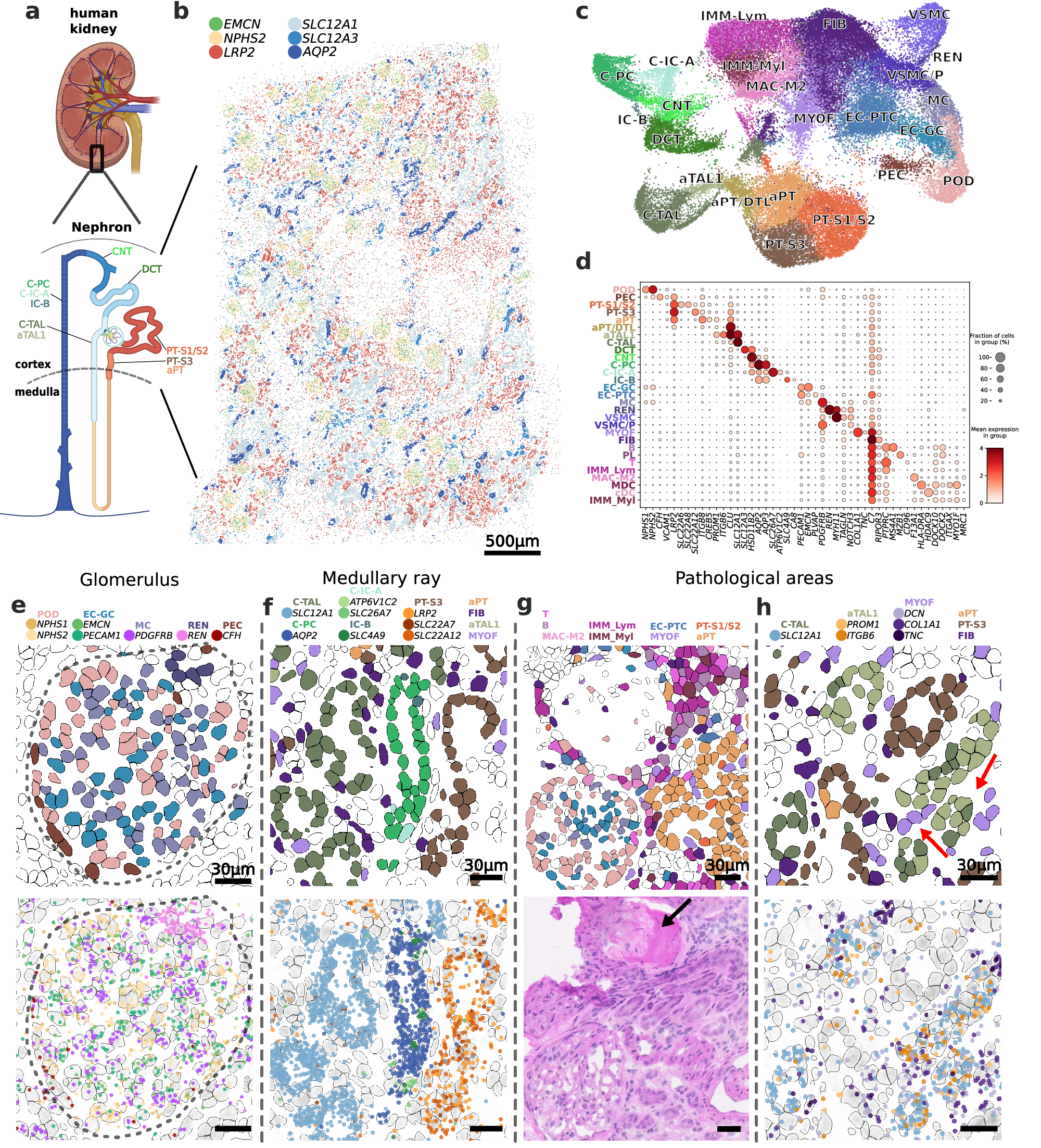 Fig. 4: DART-FISH mapping of a diseased human kidney.