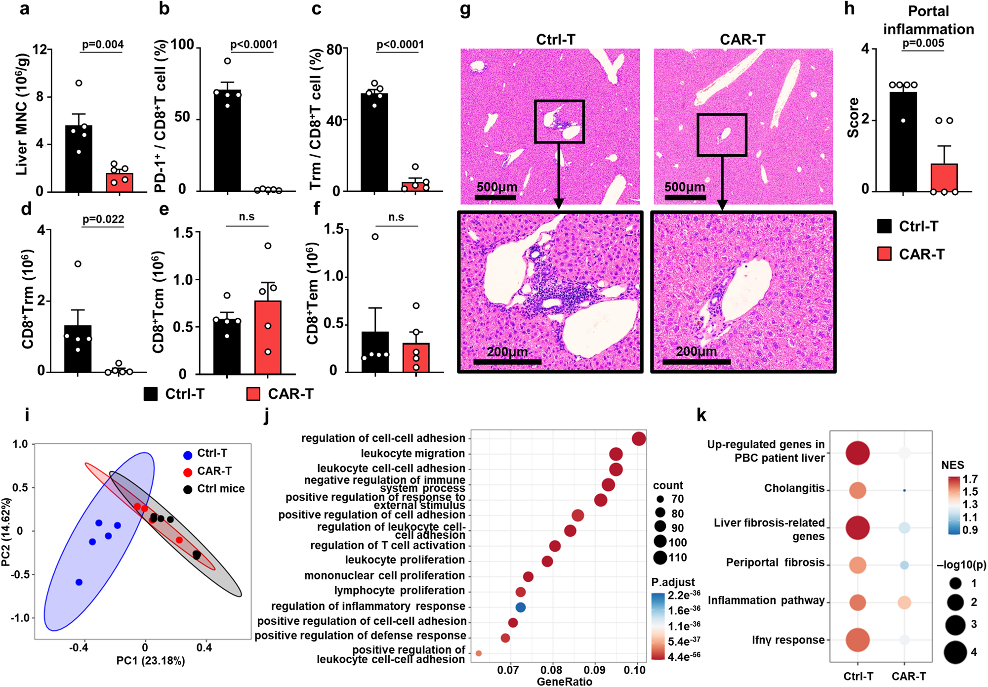Fig. 6: Depletion of liver CD8+ Trm cells by PD-1 targeting CAR-T cells ameliorates autoimmune cholangitis.