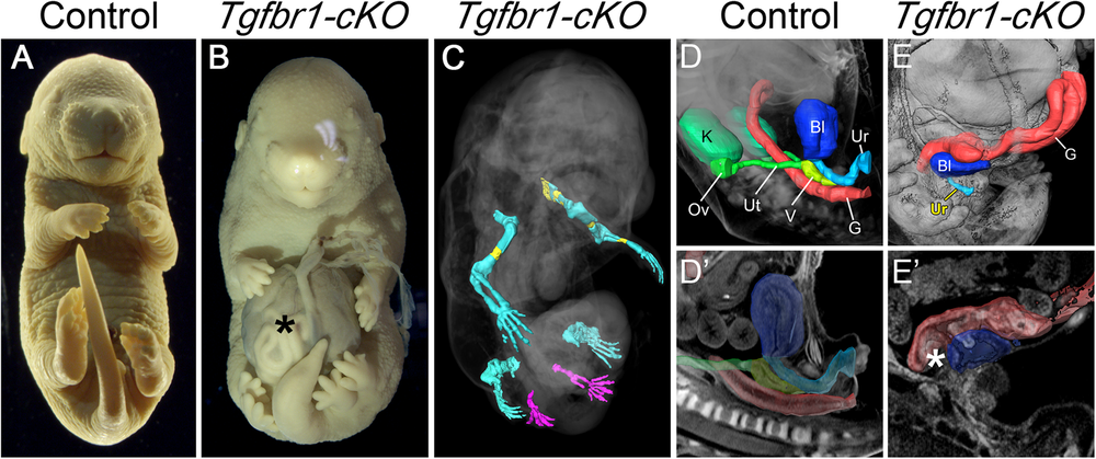 Fig. 1: Malformations in the E16.5 Tgfbr1-cKO fetuses.