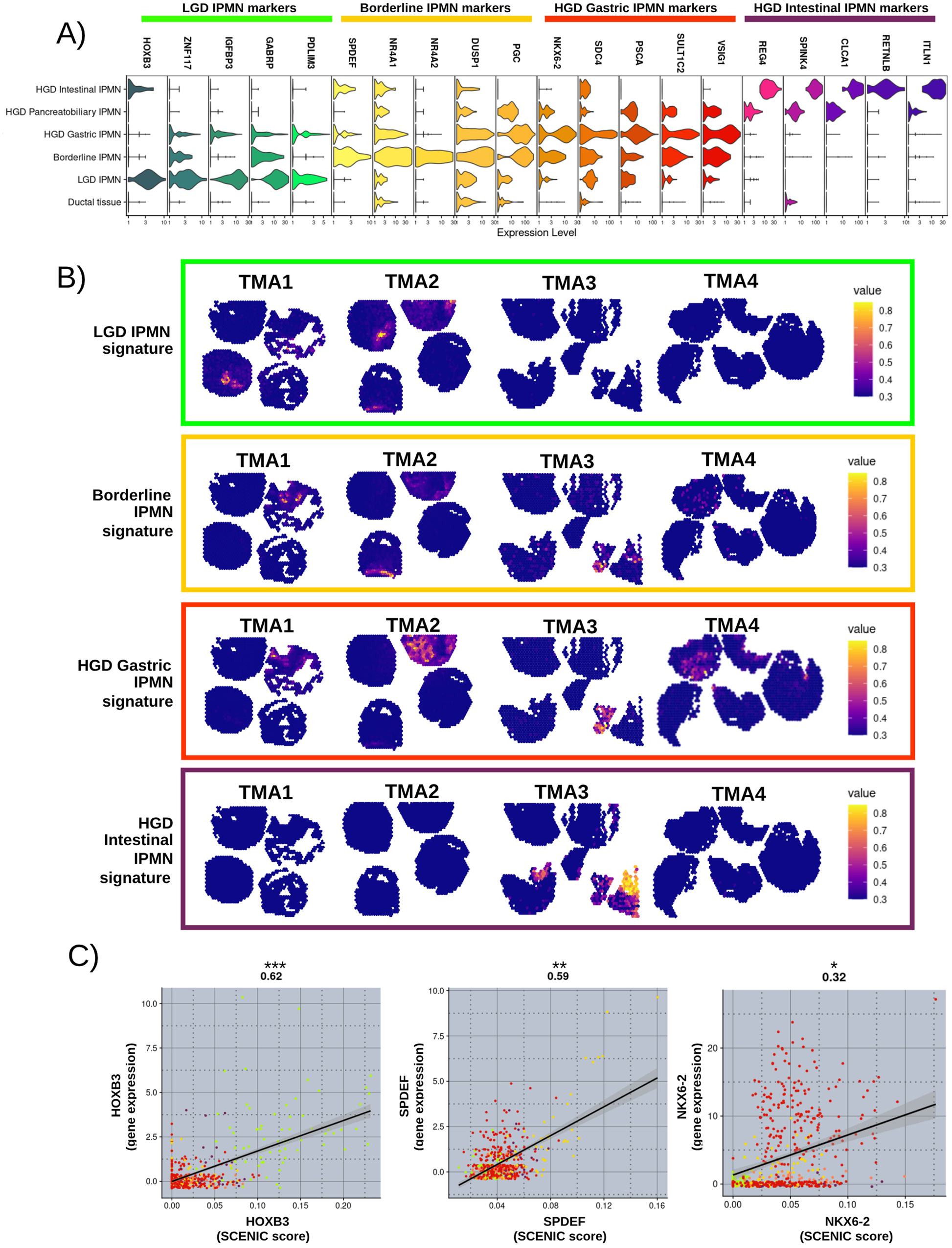 Fig. 3: IPMN cluster marker signatures.