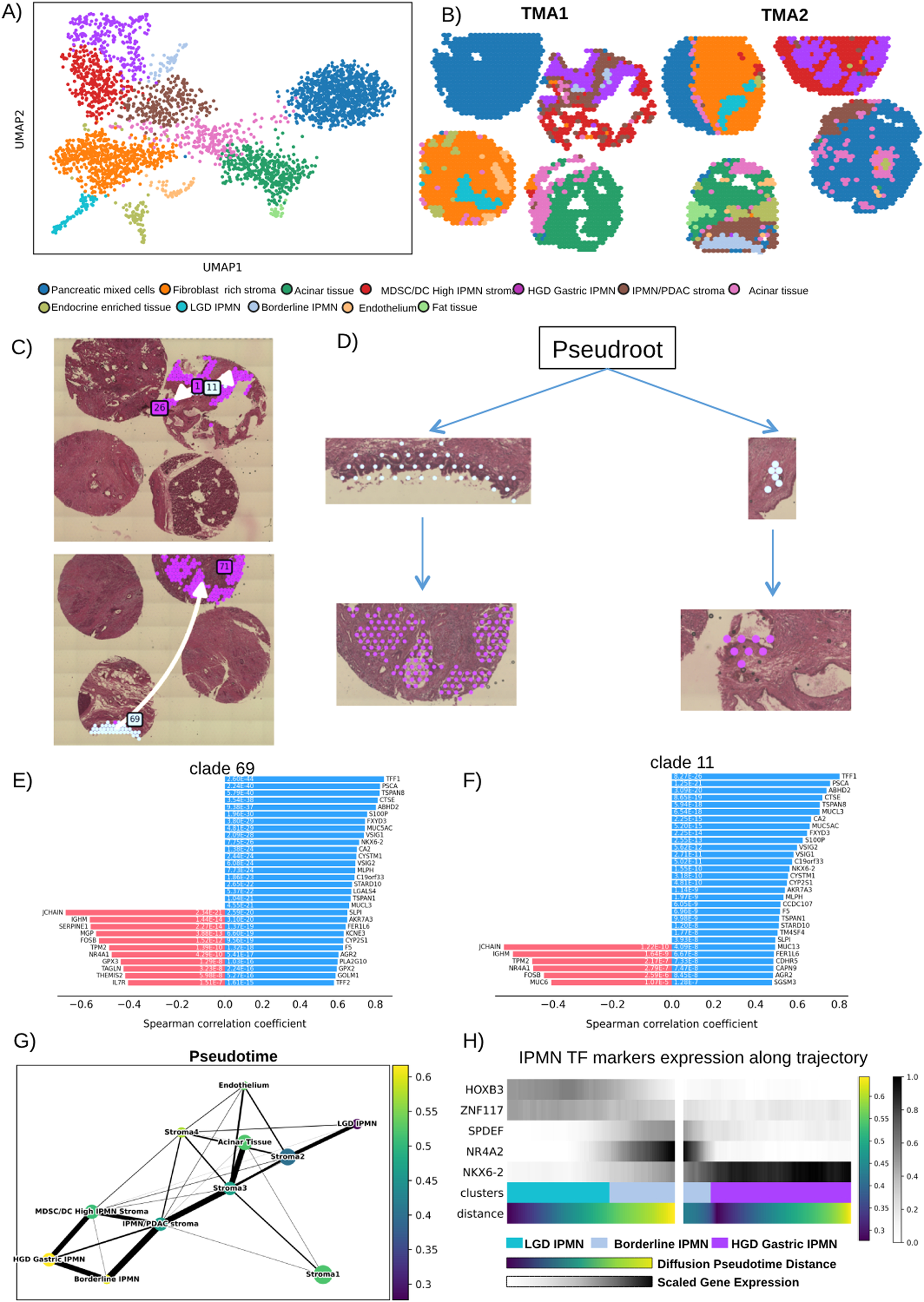 Fig. 7: stLearn clustering and spatial trajectory of gastric IPMN.