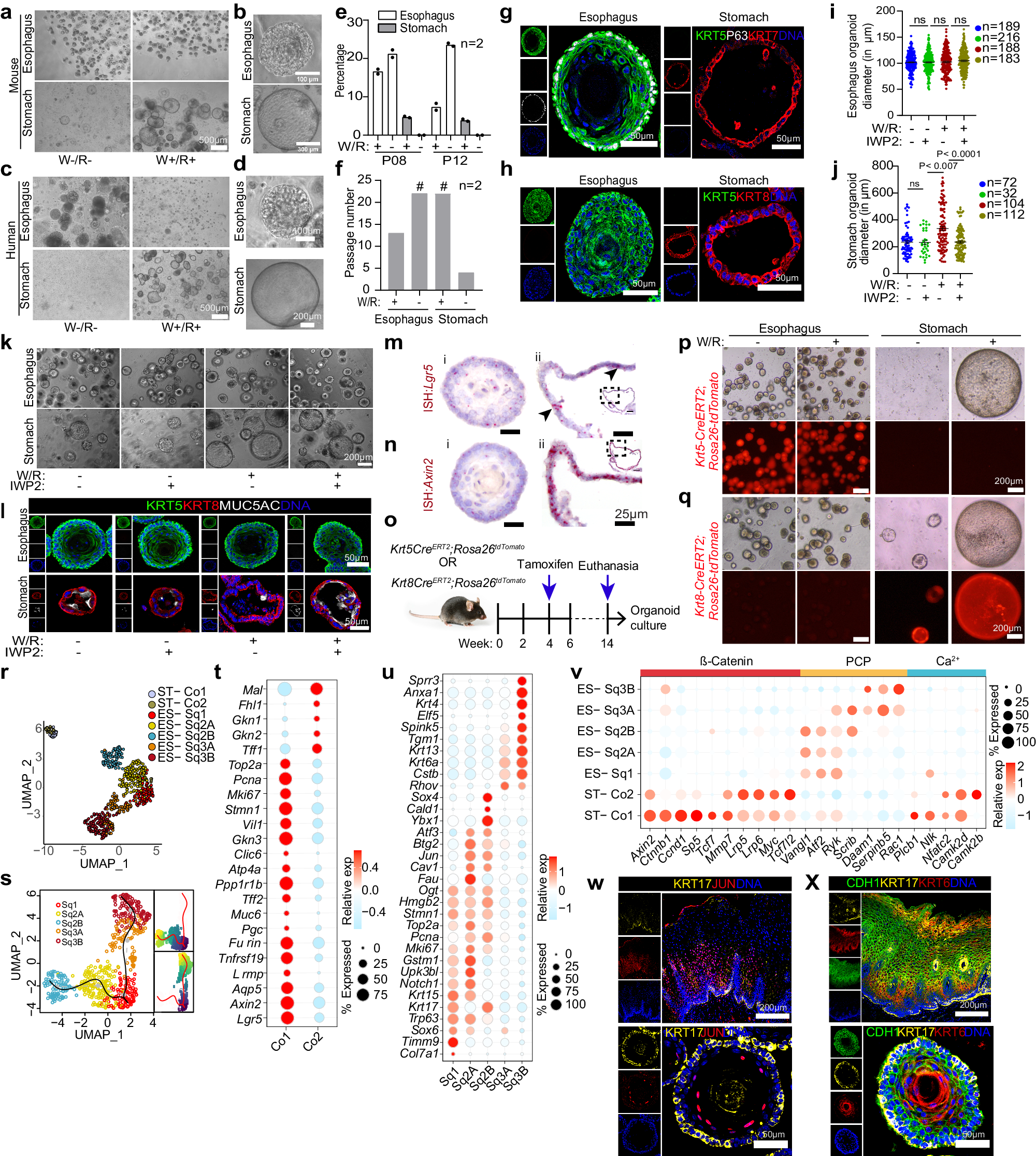 Fig. 5: Distinct WNT signaling dependency for esophageal and stomach epithelial organoid growth validates the in vivo WNT microenvironment.