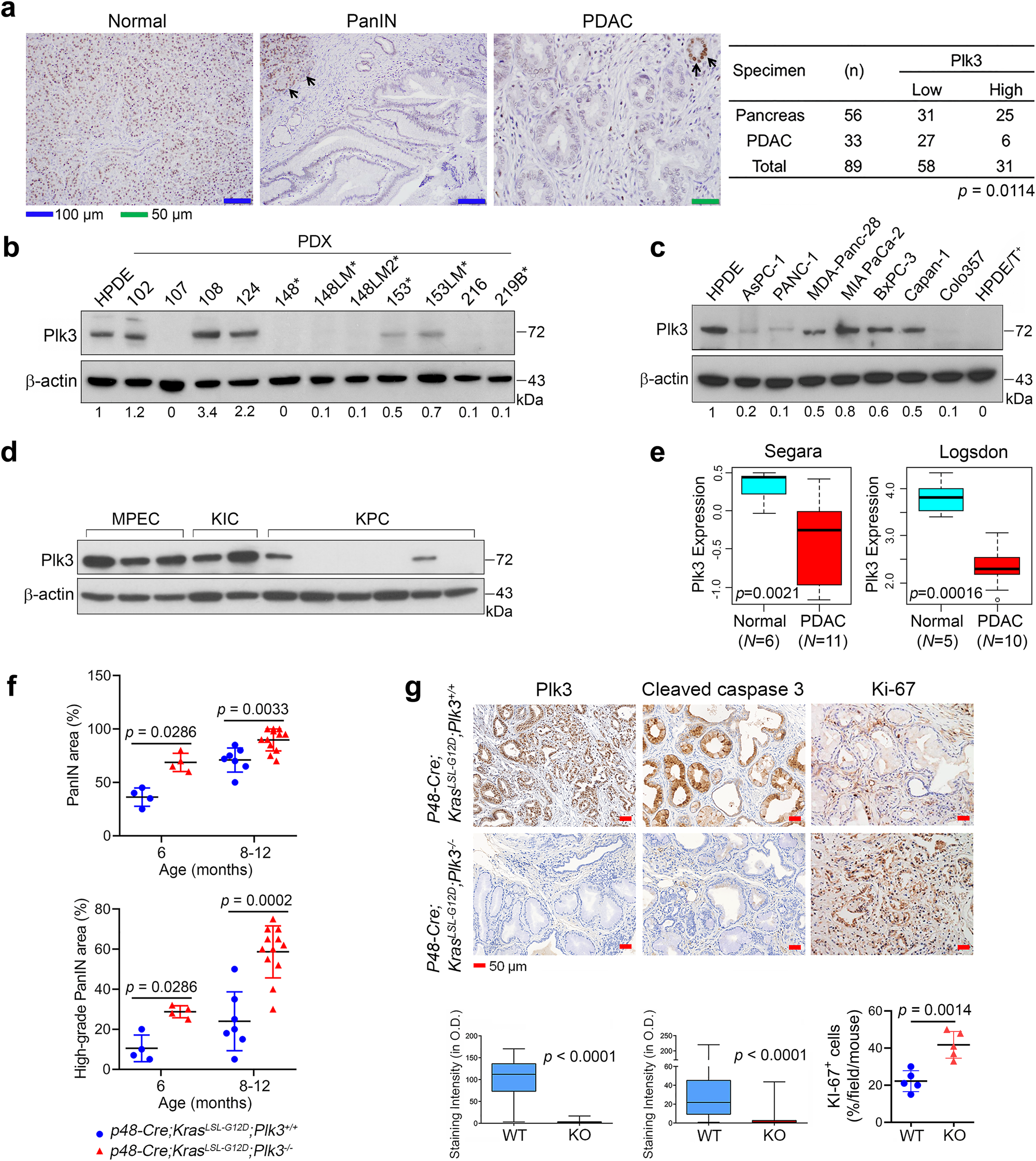 lsm-2004 pimpandhost 1038)))))))''''' Nardilysin-regulated scission mechanism activates polo-like kinase 3 to  suppress the development of pancreatic cancer | Nature Communications