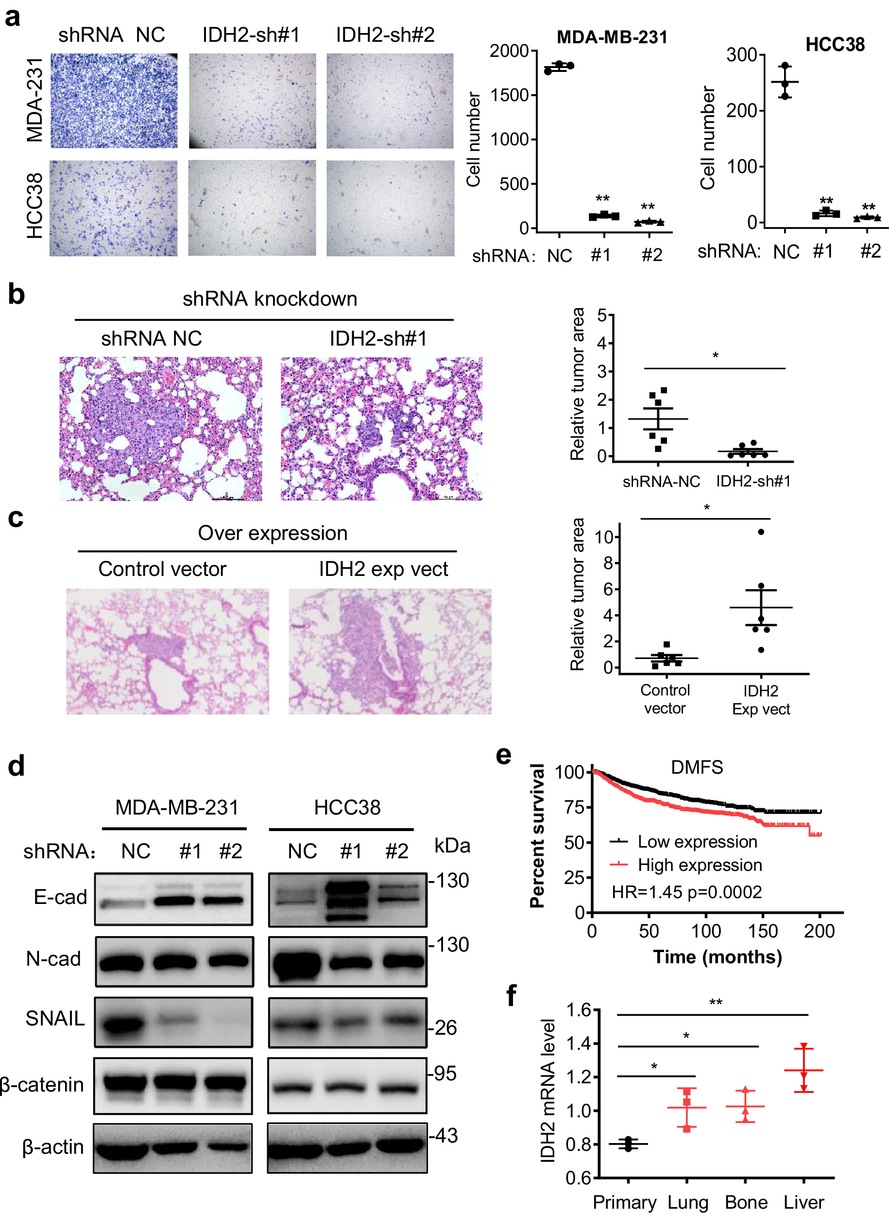 Fig. 5: Impact of IDH2 on TNBC cell migration in culture and tumor metastasis in mice.