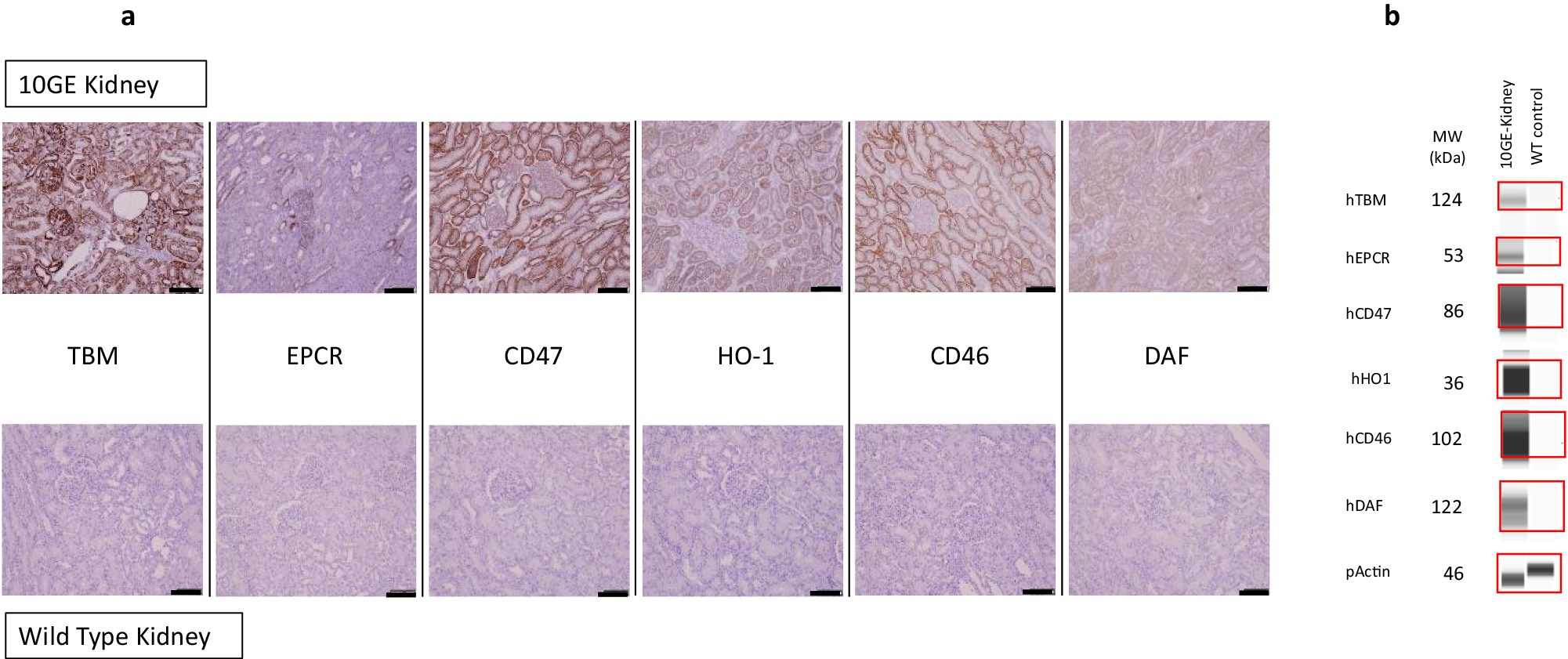 Fig. 5: Expression of human transgenes in 10GE porcine kidneys.