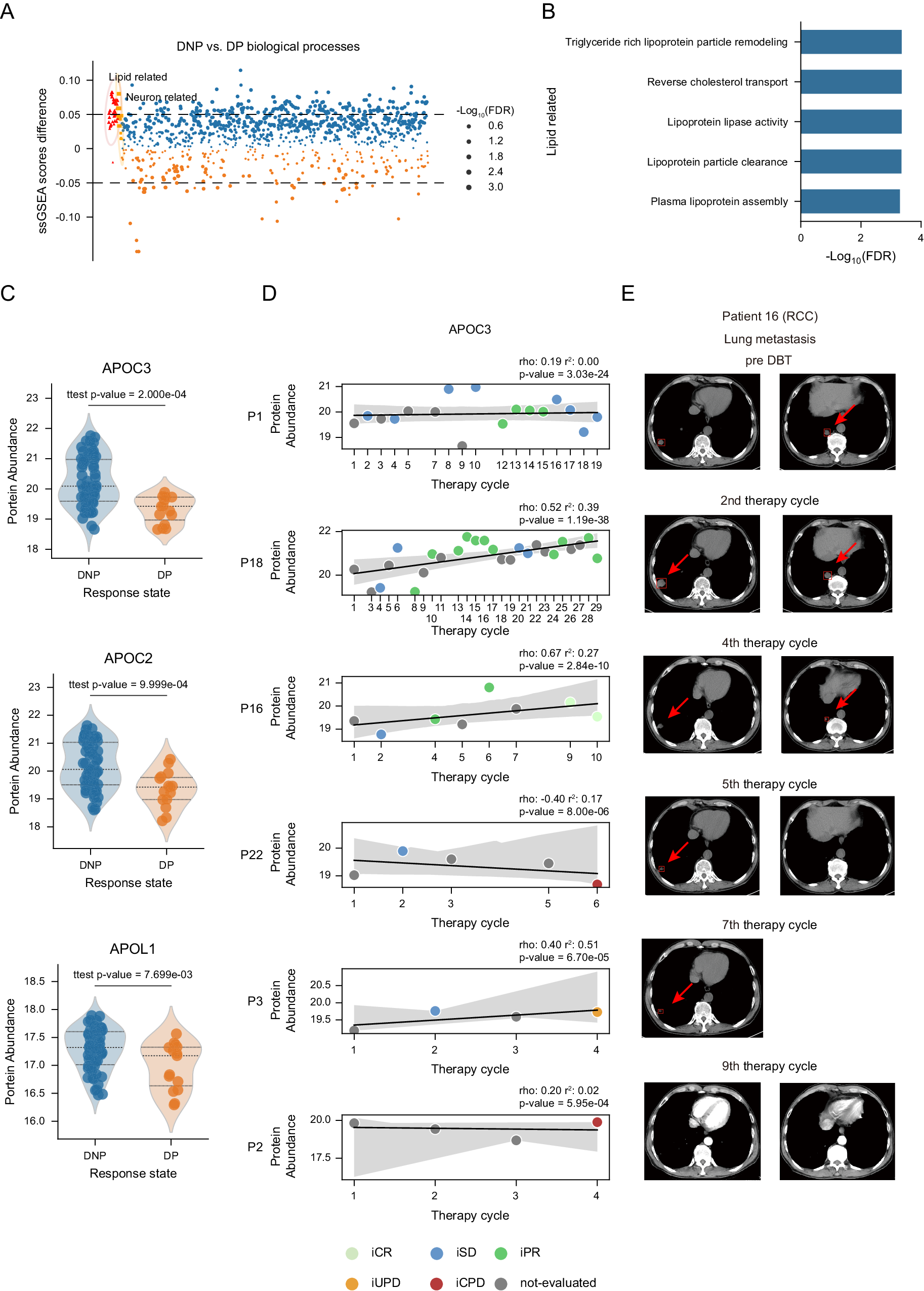 Fig. 4: Cholesterol related APOC3 showed potential as biomarker in DBT.