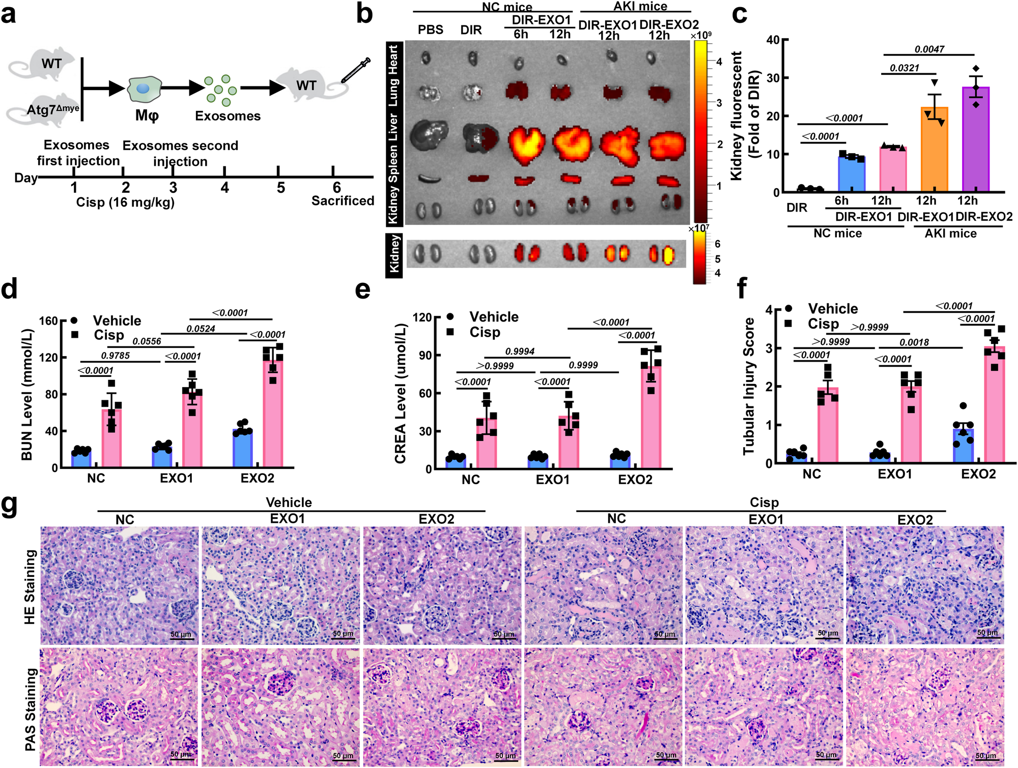 Fig. 4: Exosomes derived from ATG7-deficient macrophages (Mφs) exacerbate kidney injury in vivo.
