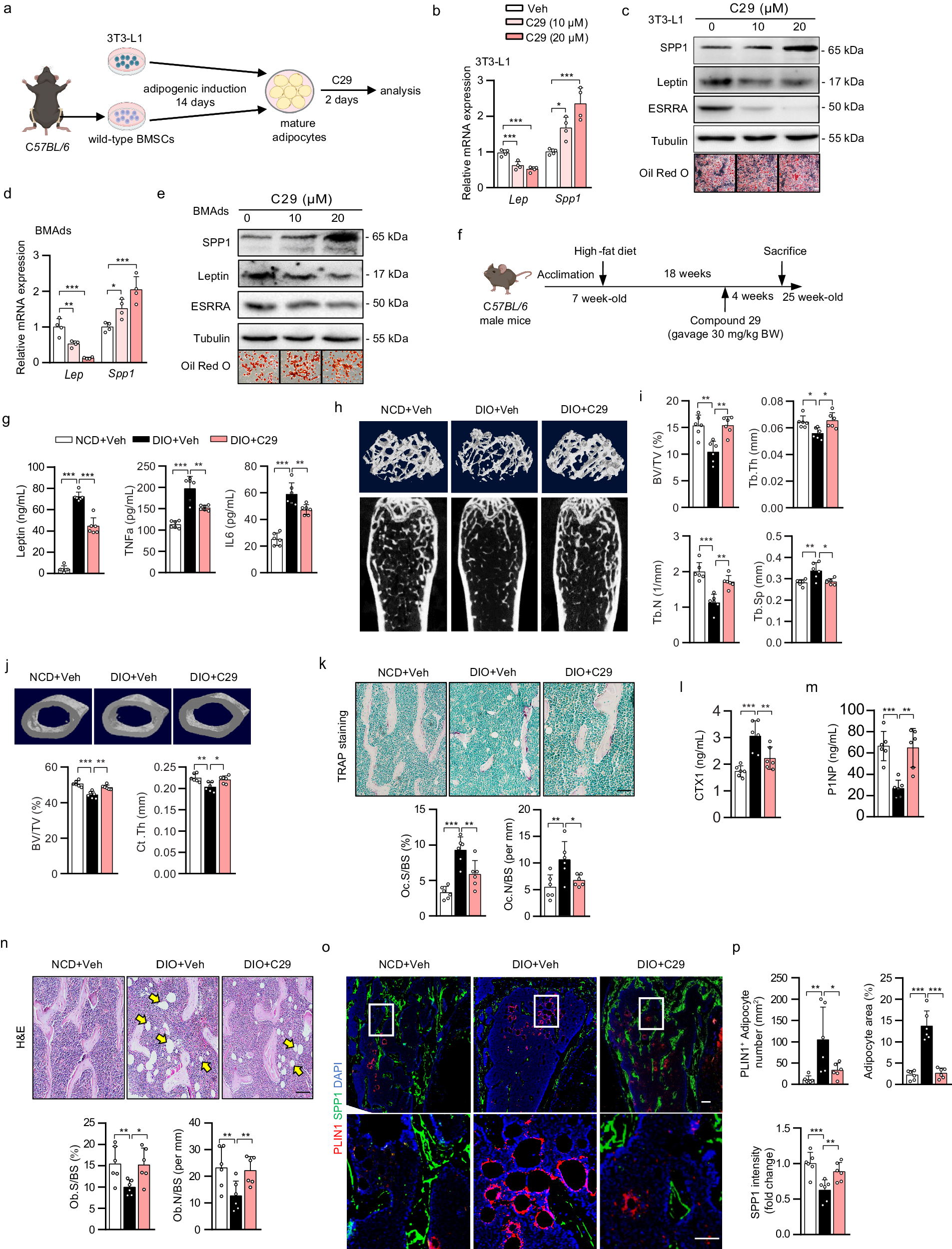 Fig. 8: Pharmacological inhibition of ESRRA protects DIO mice from bone loss and MAT expansion.