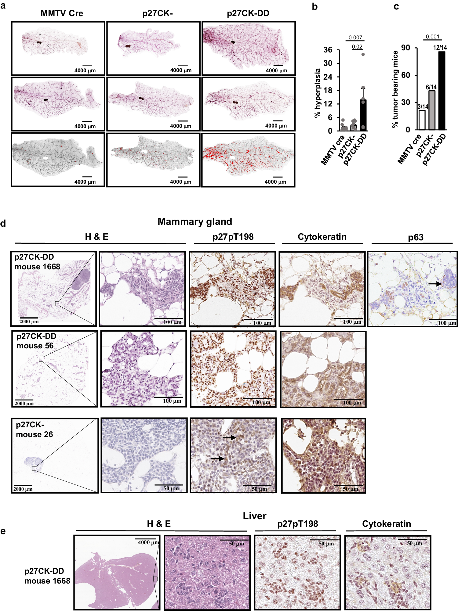 Fig. 7: Mammary transgenic expression of p27CK-DD increases mammary duct branching, mammary hyperplasia and yields mammary cancers that generate liver metastases.