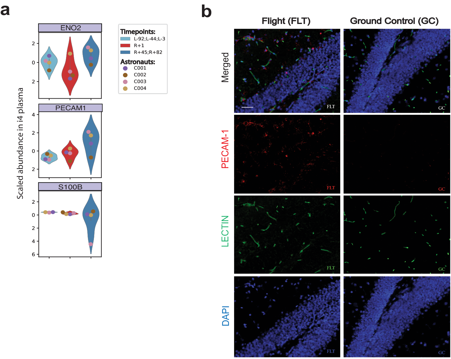 Fig. 6: Blood Brain Barrier integrity markers in spaceflight.