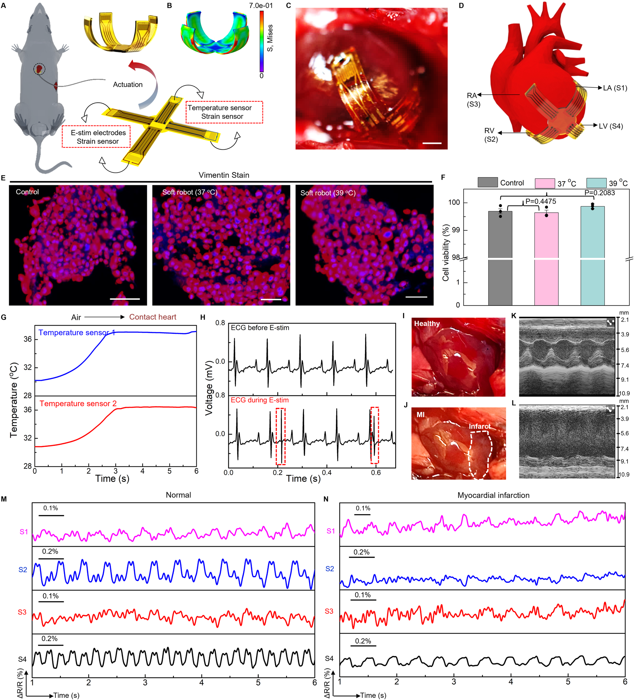 Fig. 6: In vivo validation of a soft robotic thera-gripper for epicardial sensing and electrical stimulation (E-stim).