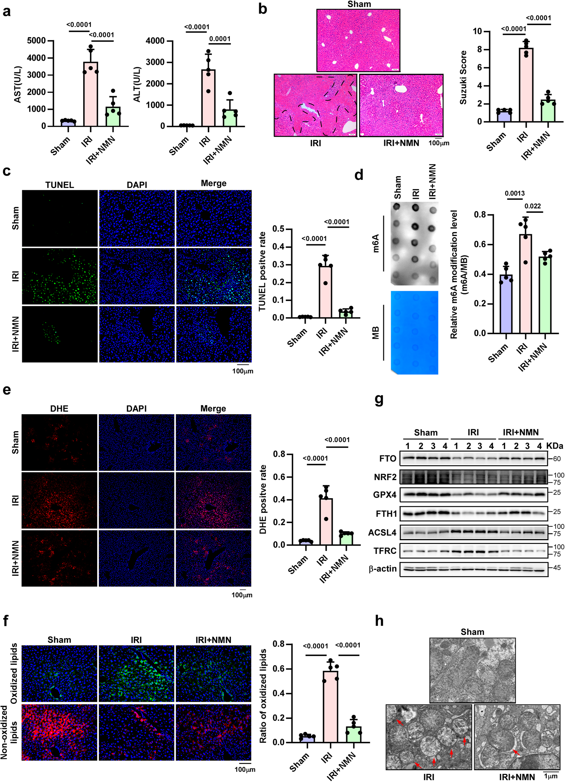 Fig. 7: NMN mitigates older HIRI by increasing the demethylase activity of FTO.