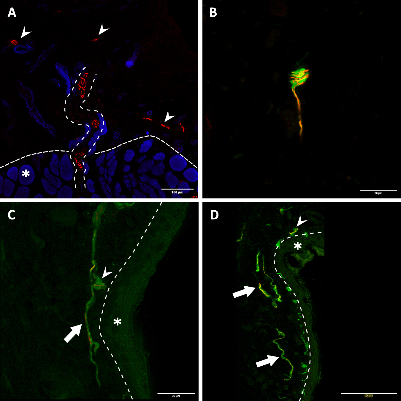Fig. 2: Transmuscular reinnervation of the skin.