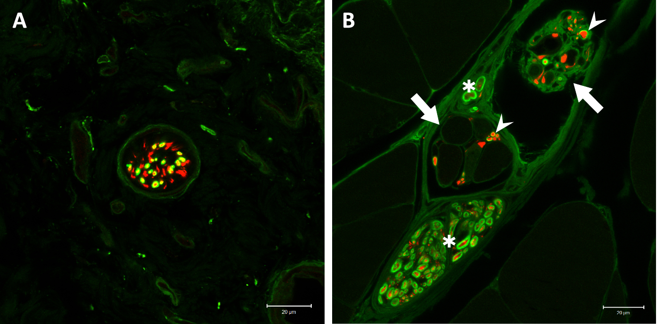 Fig. 3: Morphology of the reinnervating nerve fibers.