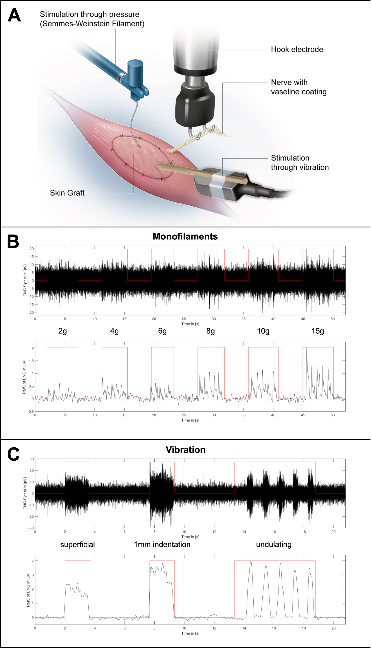 Fig. 9: Electroneurographic recordings (filtered ENG signal and its root mean square) after touch and vibration stimulus in the experimental group.