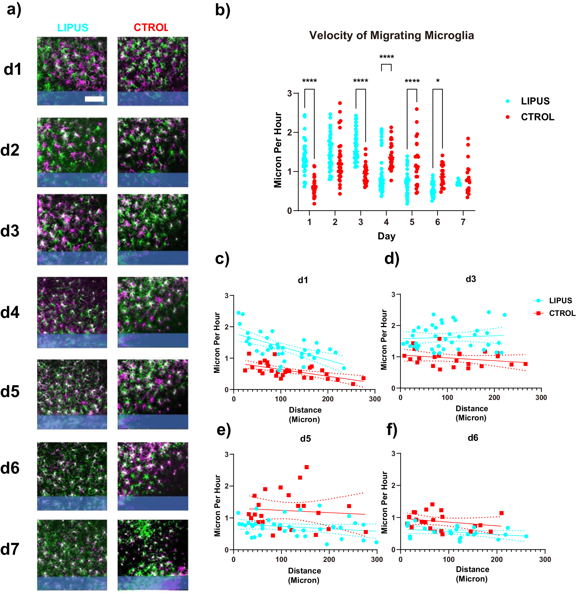 Fig. 2: LIPUS increased the velocity of migrating microglia on day 1 and day 3.