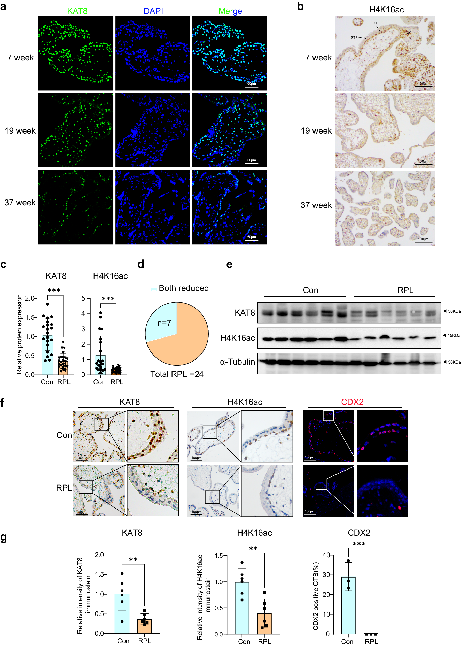 Fig. 7: The expression of KAT8 and H4K16ac in placenta villous of normal pregnancies and RPL patients.