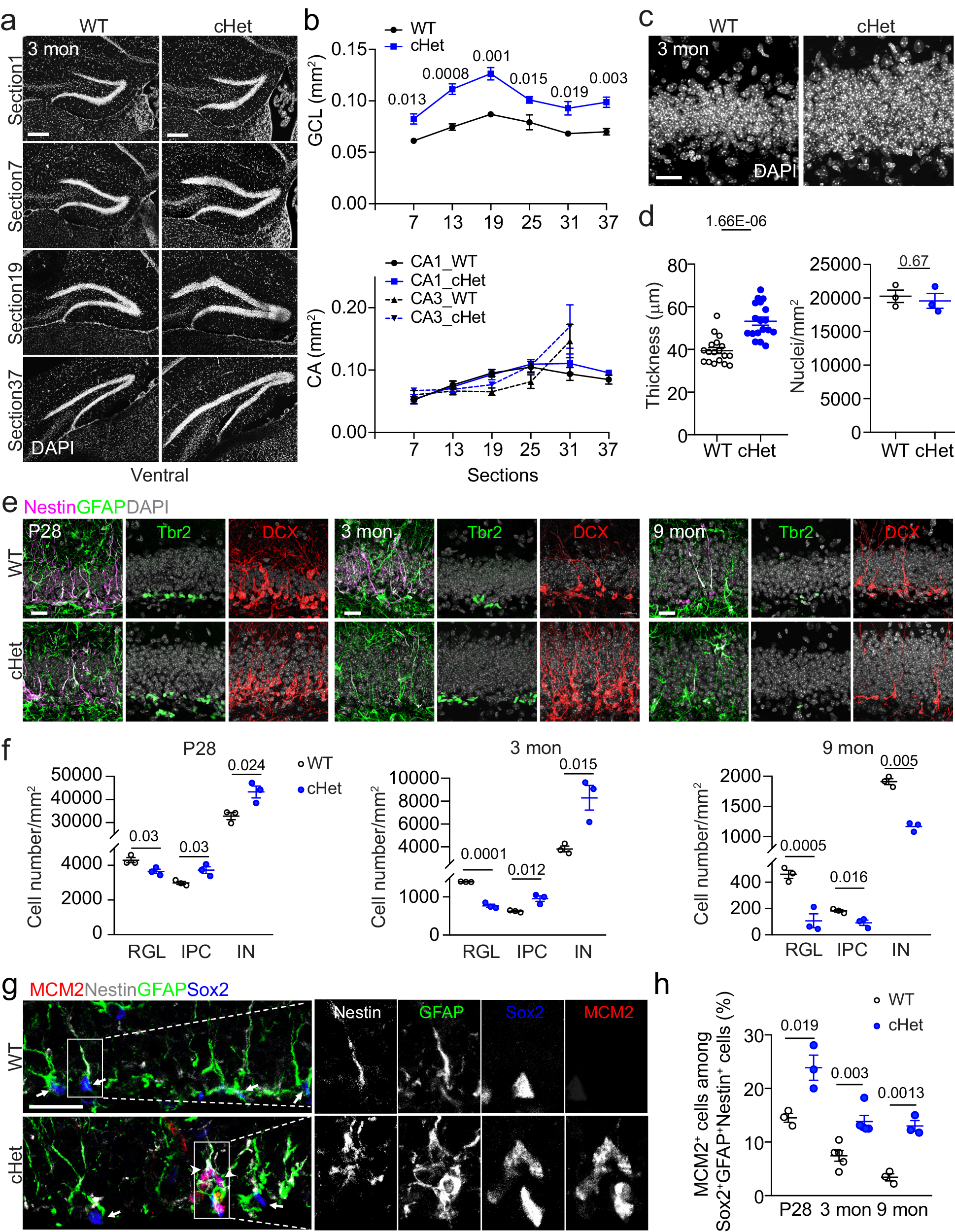 Fig. 1: Setd1a haploinsufficiency results in an enlarged DG and elevated activation of DG quiescent RGLs in the adult mice.