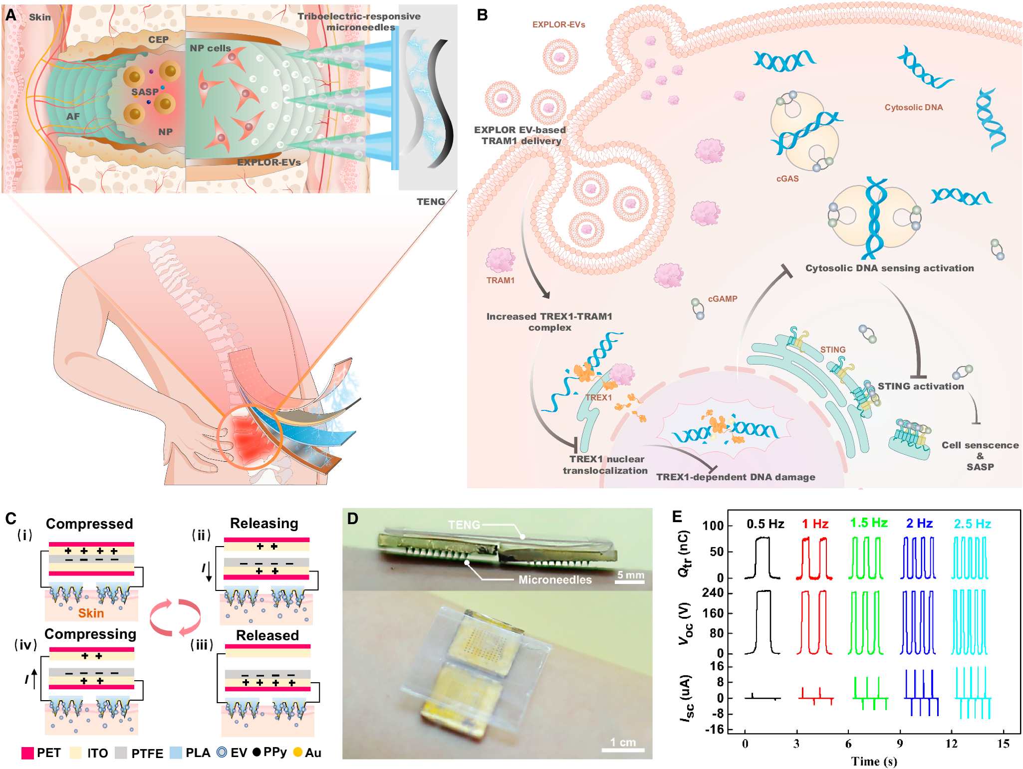 Fig. 1: Self-powered triboelectric-responsive MNs with controllable release of EXPLOR engineered EV for IVDD repair.