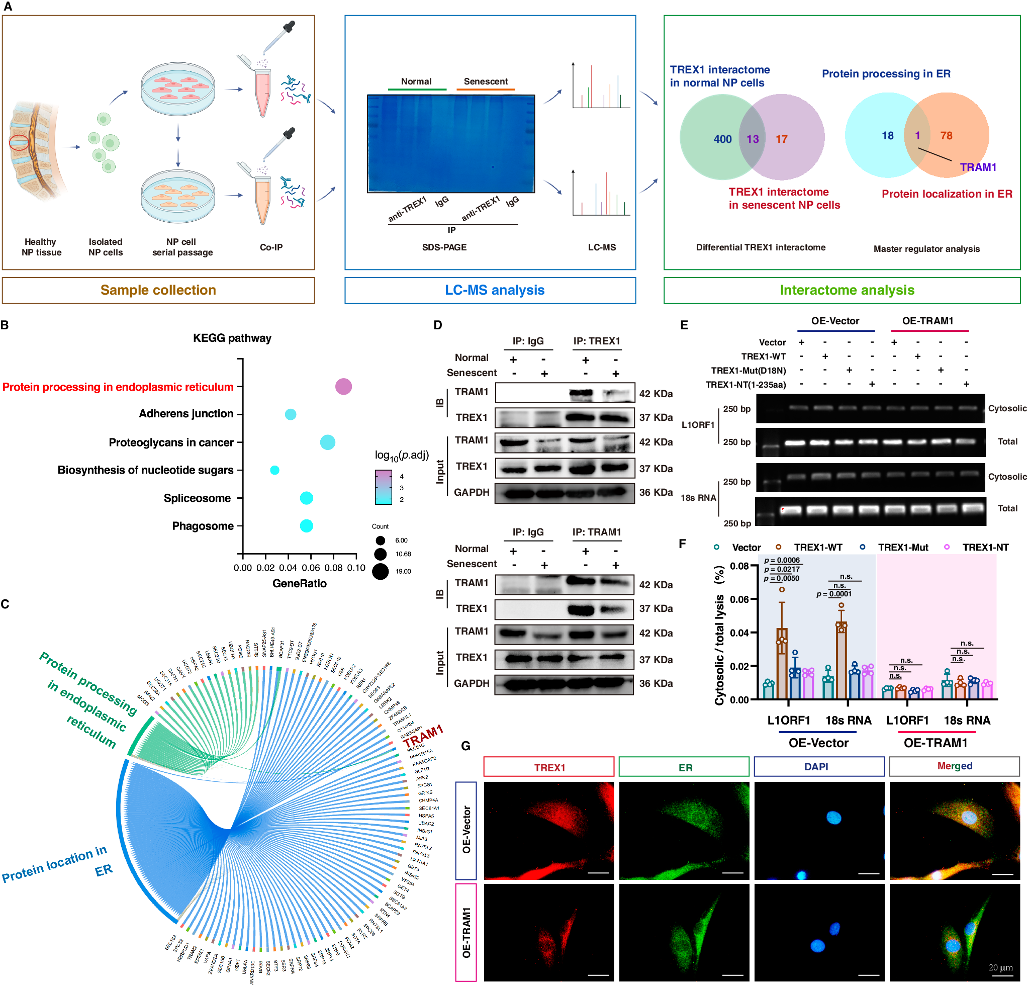 Fig. 4: Interactomic analysis revealed that disassembly of the TRAM1-TREX1 complex promoted TREX1 mislocalization and activation of cytosolic DNA-sensing pathway during NP cell senescence.
