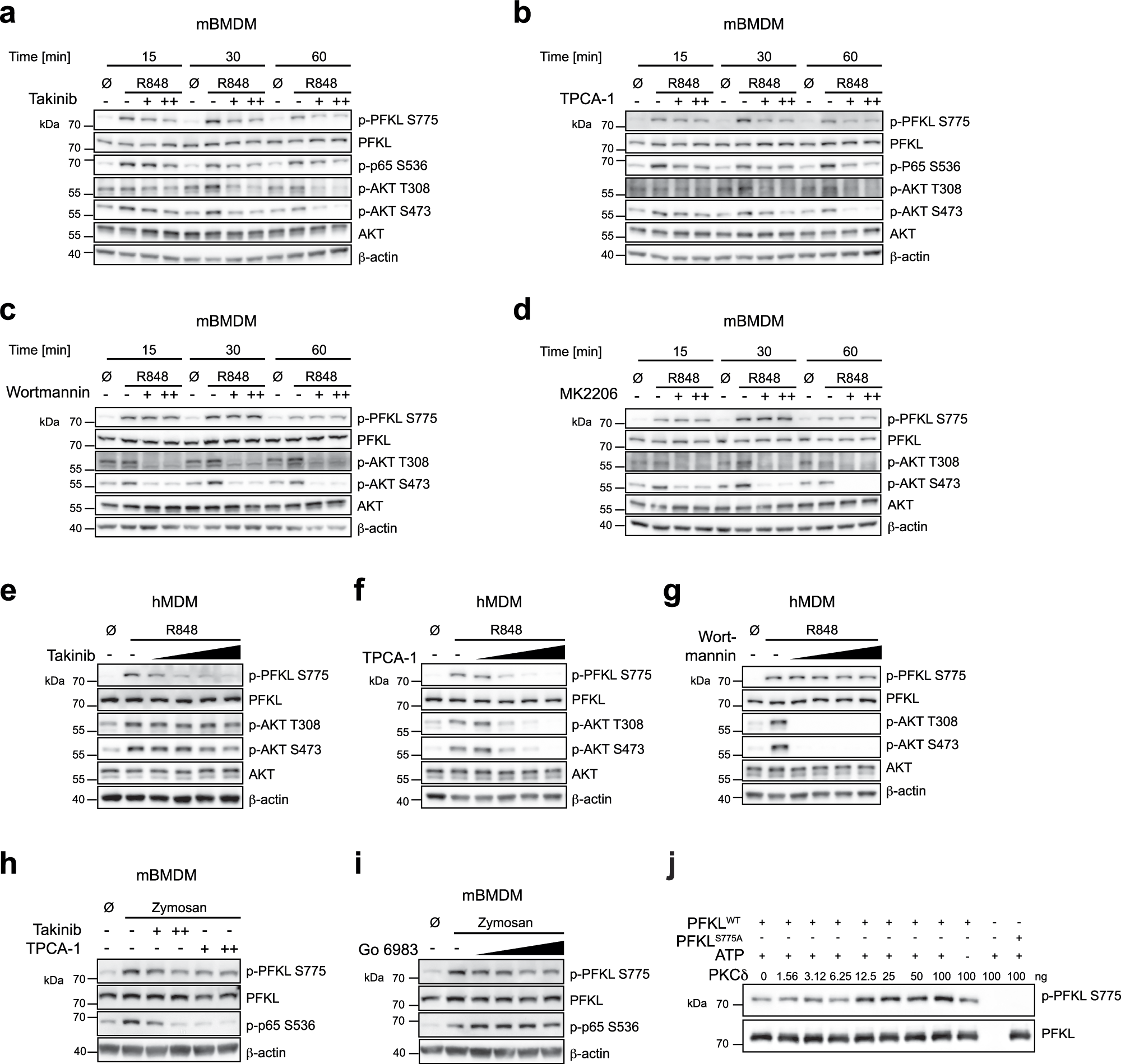 Fig. 2: The IKK complex and PKC function in PFKL Ser775 phosphorylation.