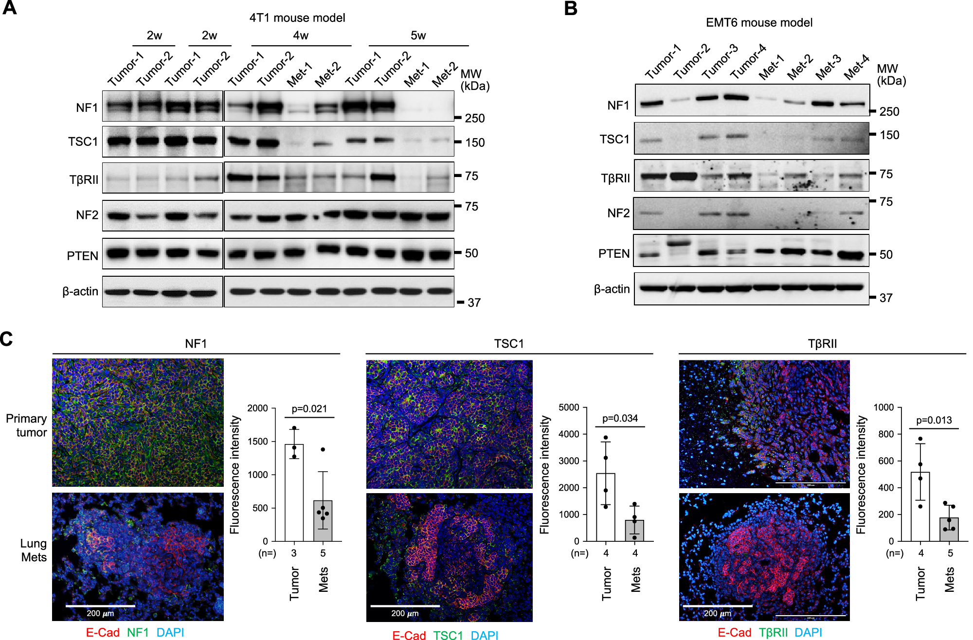 Fig. 4: NF1, TSC1, and TβRII were decreased in metastasis nodules in TNBC mouse models.