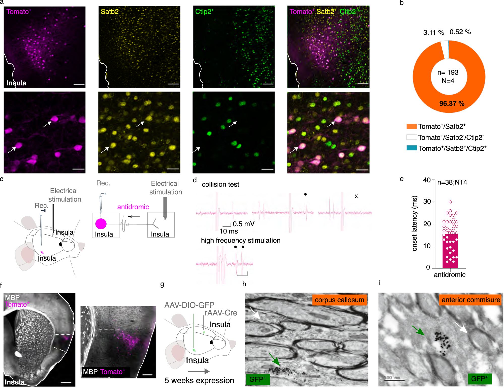 Fig. 2: Molecular and electrophysiological characterization of InsulaIns neurons.