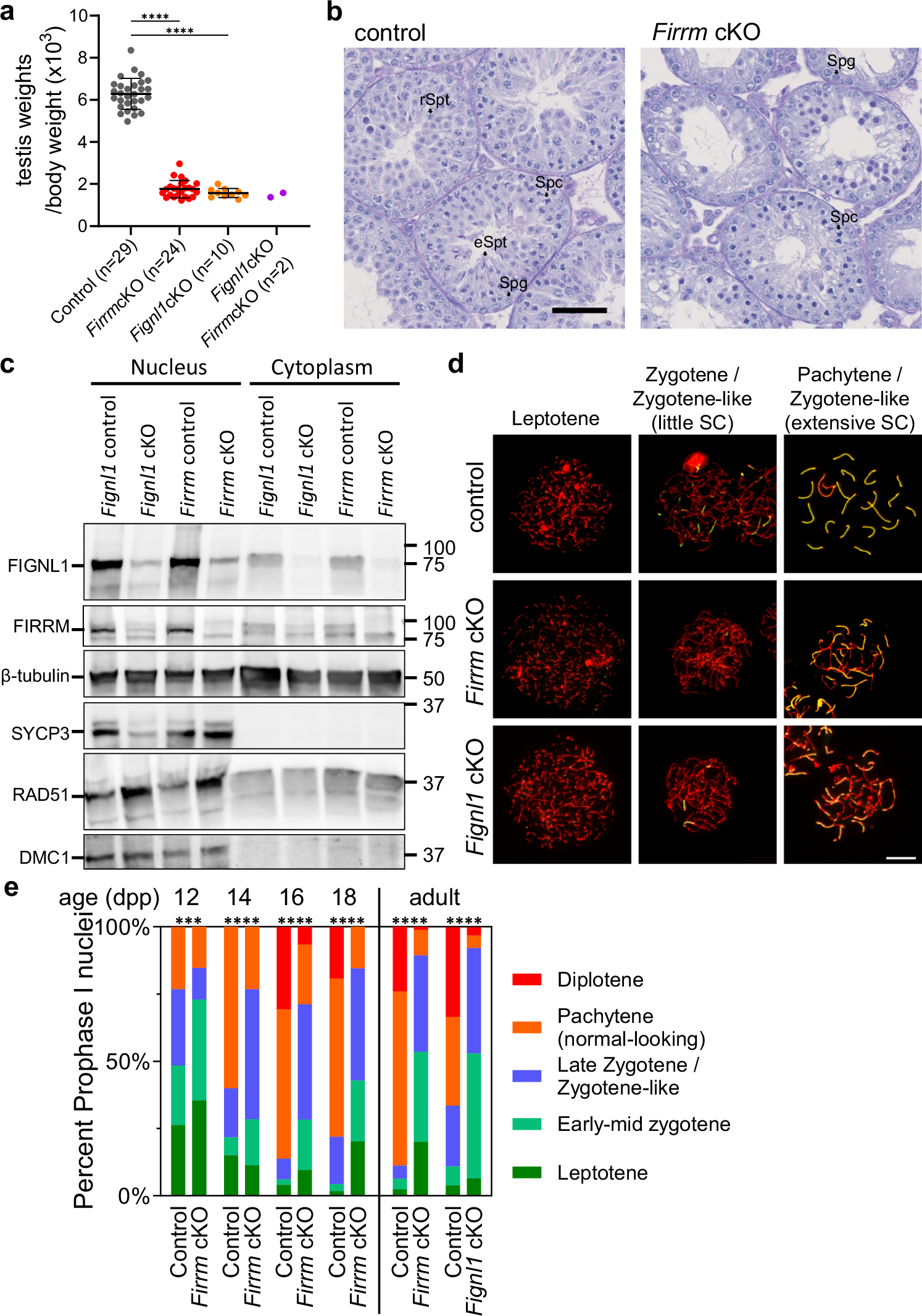 fignl1-firrm-is-essential-for-meiotic-recombination-and-prevents-dna-damage-independent-rad51-and-dmc1-loading-nature-communications