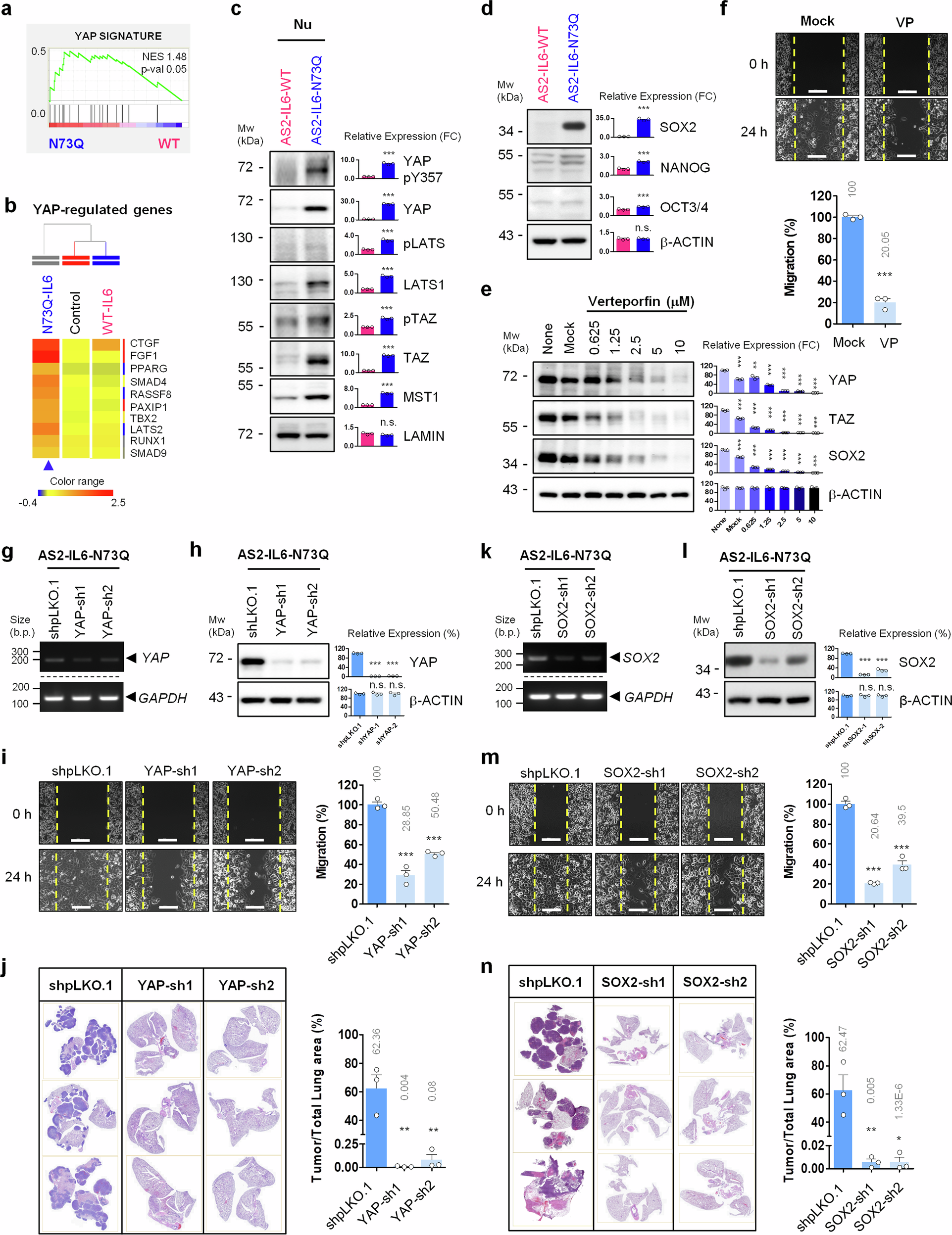 Fig. 5: SOX2 Contributes to deNG-IL6-Induced SRC-YAP Axis-Promoted Migration and Metastasis.