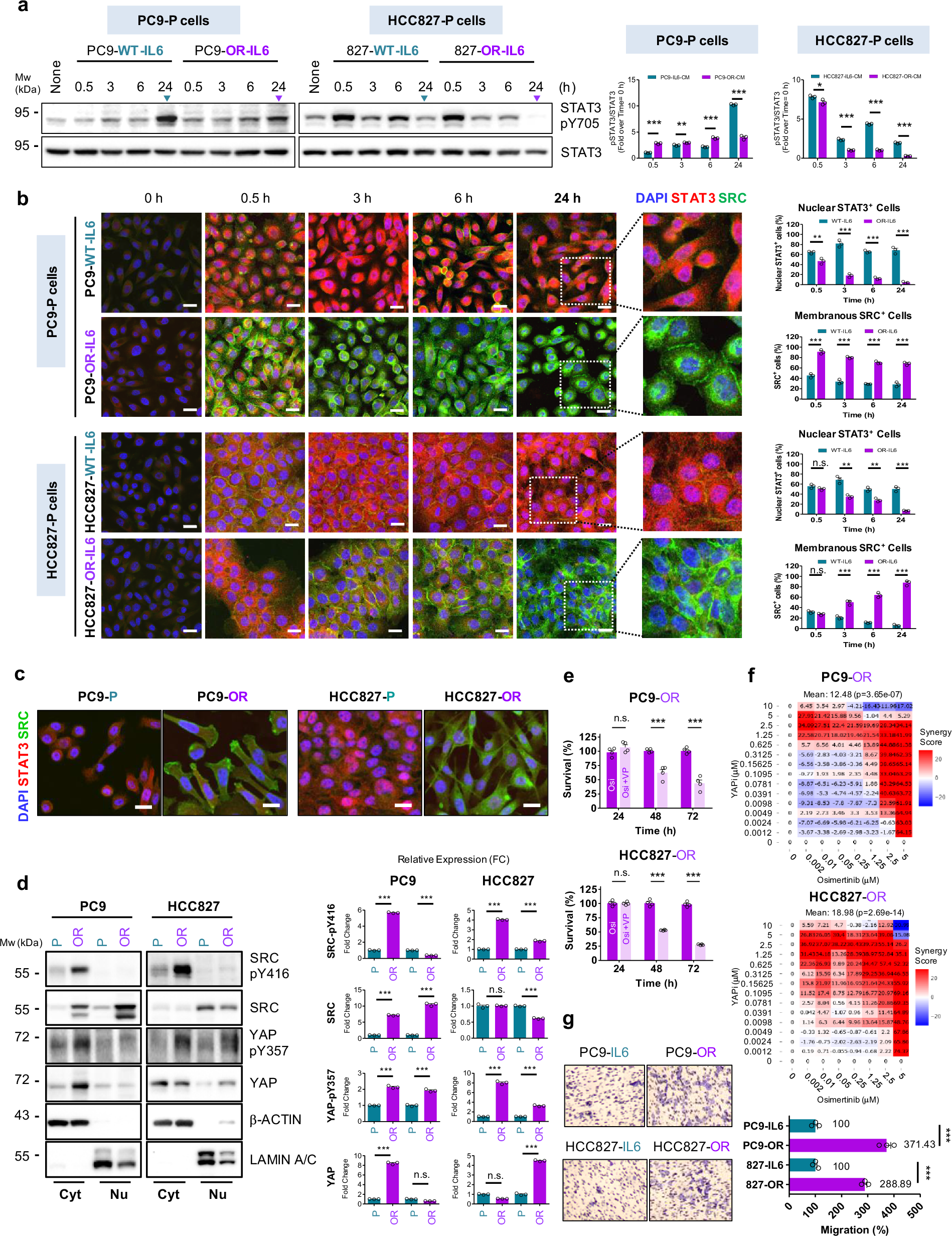 Fig. 7: Osimertinib-induced deNG-IL6 activates the SRC-YAP-SOX2 axis and migration in TKI-resistant NSCLC.