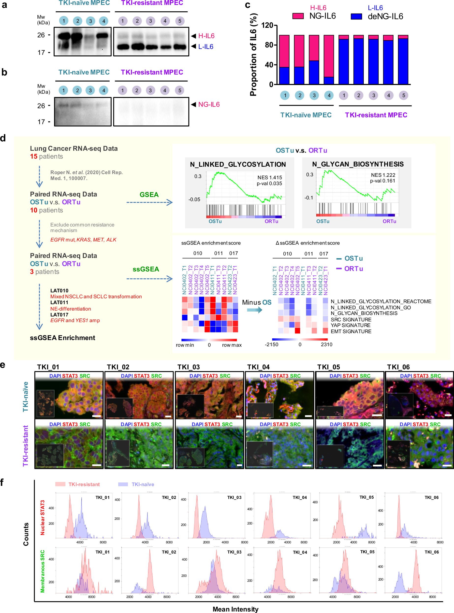 Fig. 8: EGFR TKI-resistant NSCLC patients show high deNG-IL6 expression and a shift signaling preference from JAK-STAT3 to the SRC-YAP axis.
