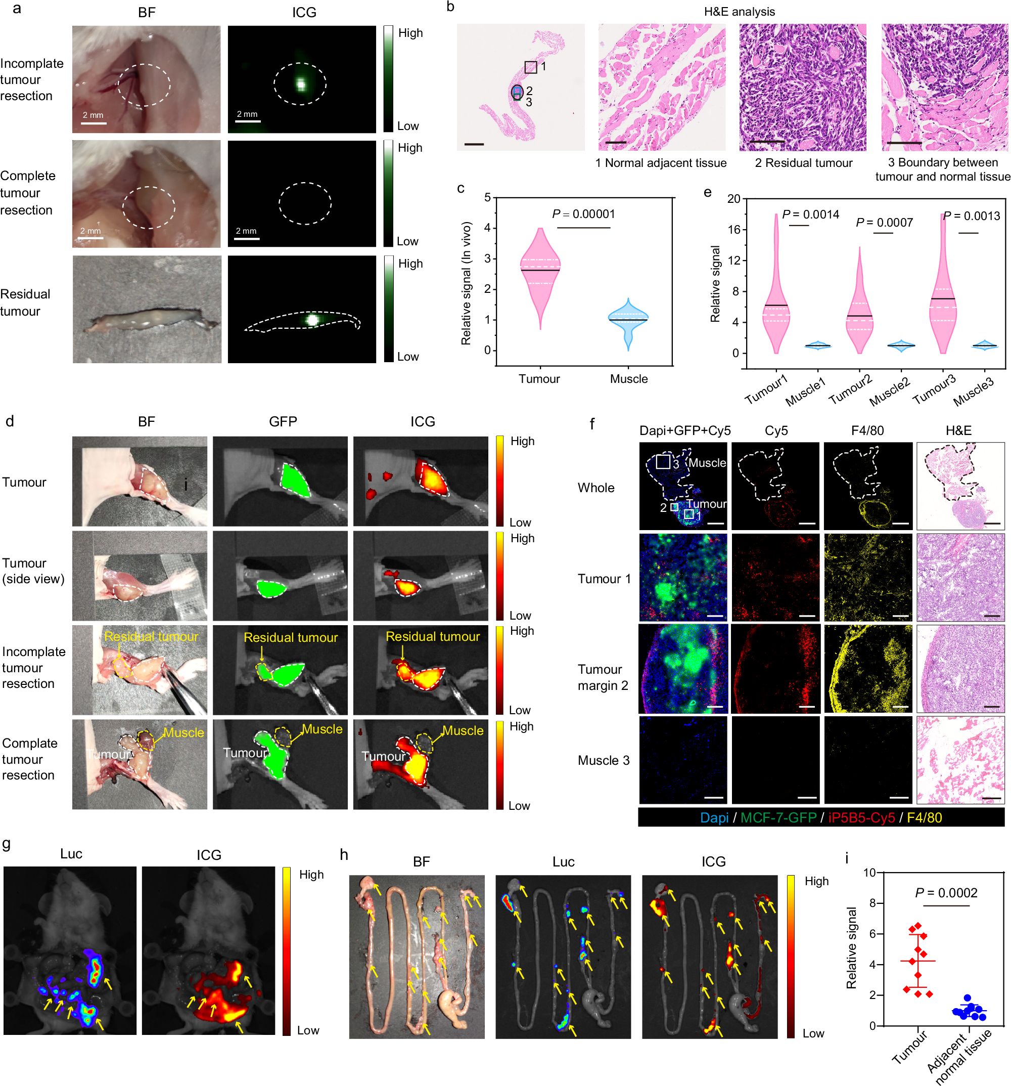 Fig. 6: iP5B5-ICG for image-guided tumour surgery.