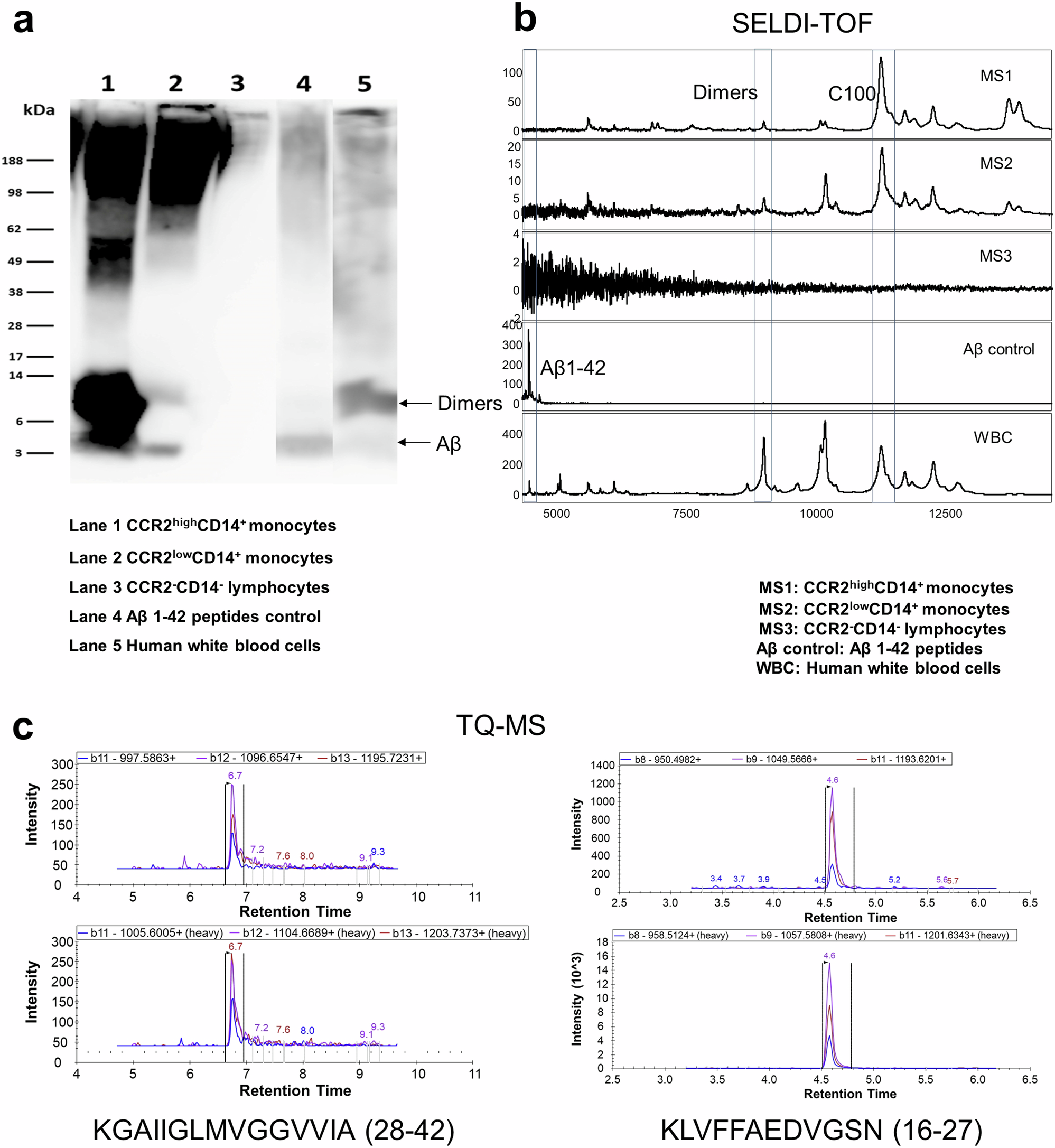 Fig. 3: Confirmation of Aβ1-42 presence on Aβ-binding monocytes in blood.