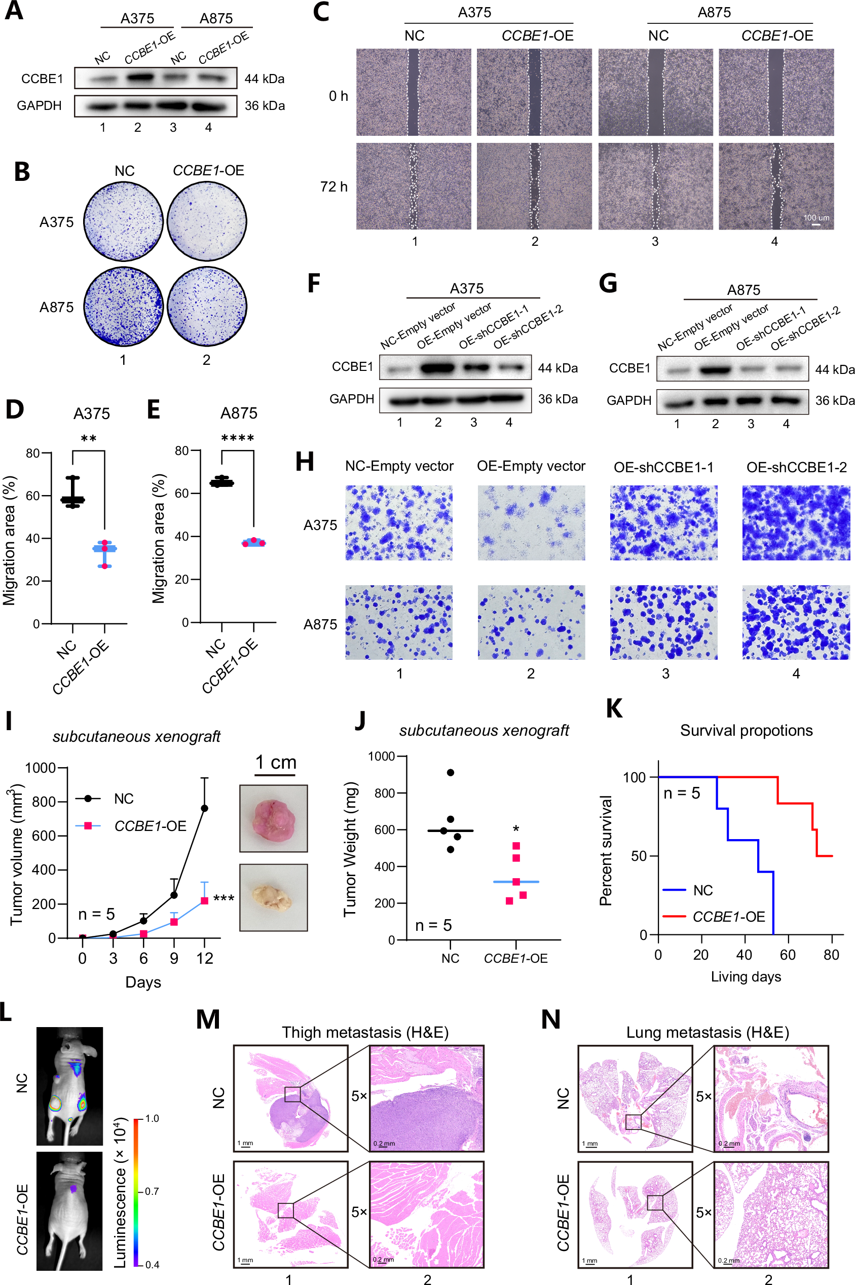 Fig. 6: CCBE1 functions as a tumor suppressor in the tumorigenesis of melanoma.