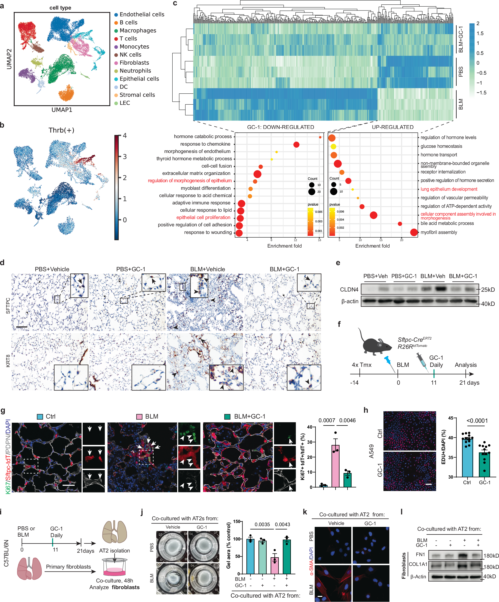 Fig. 4: Activation of TRβ constrains the metaplasia and hyperplasia of AT2 cells in fibrosis.