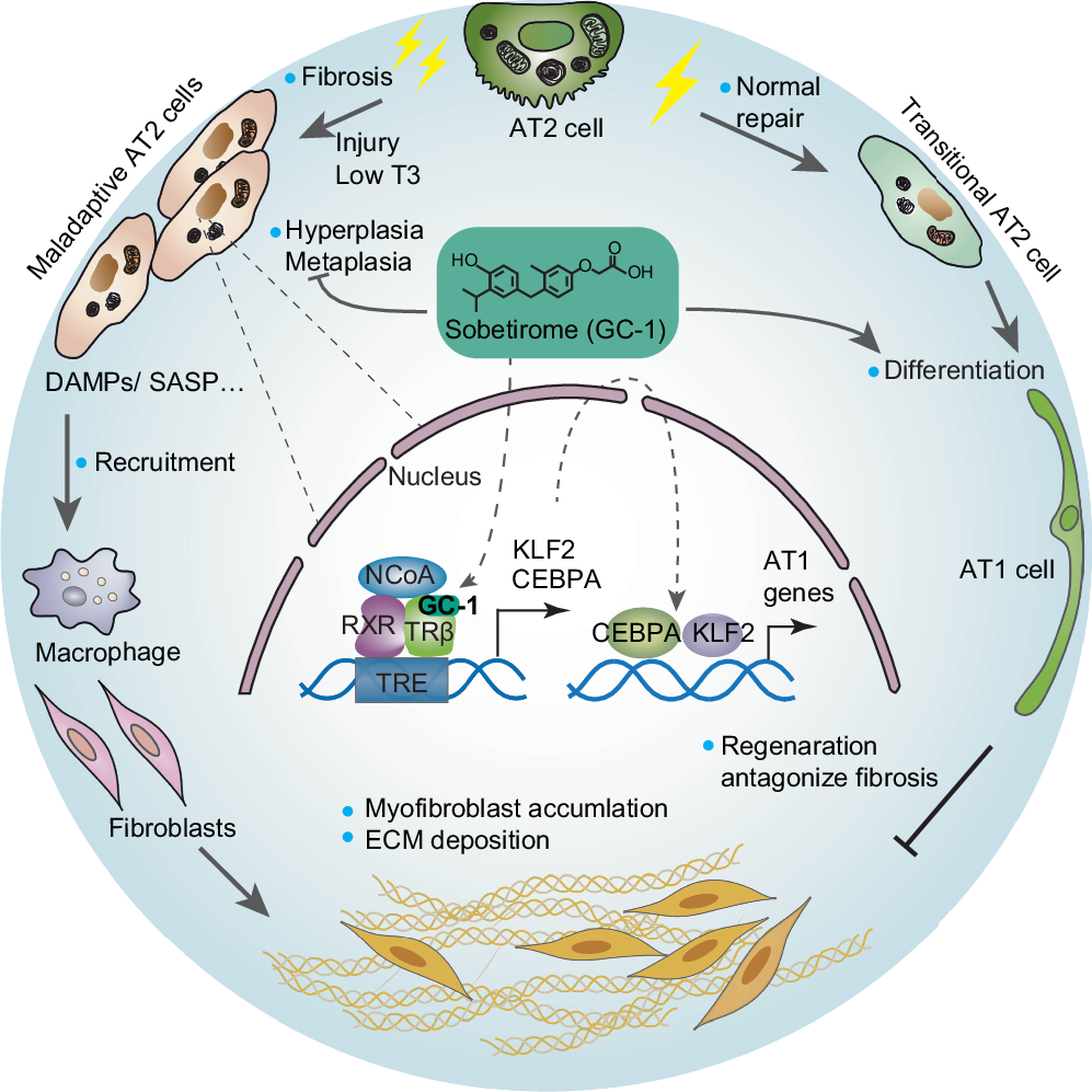 Fig. 9: Work model of the pro-regeneration and anti-fibrotic effects of TRβ activation.