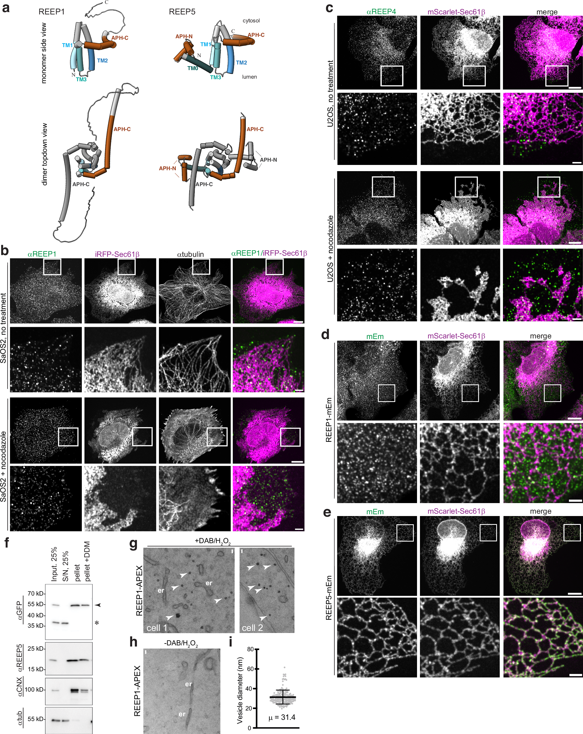 Fig. 1: REEP1 and REEP4 localize to vesicles in mammalian cells.