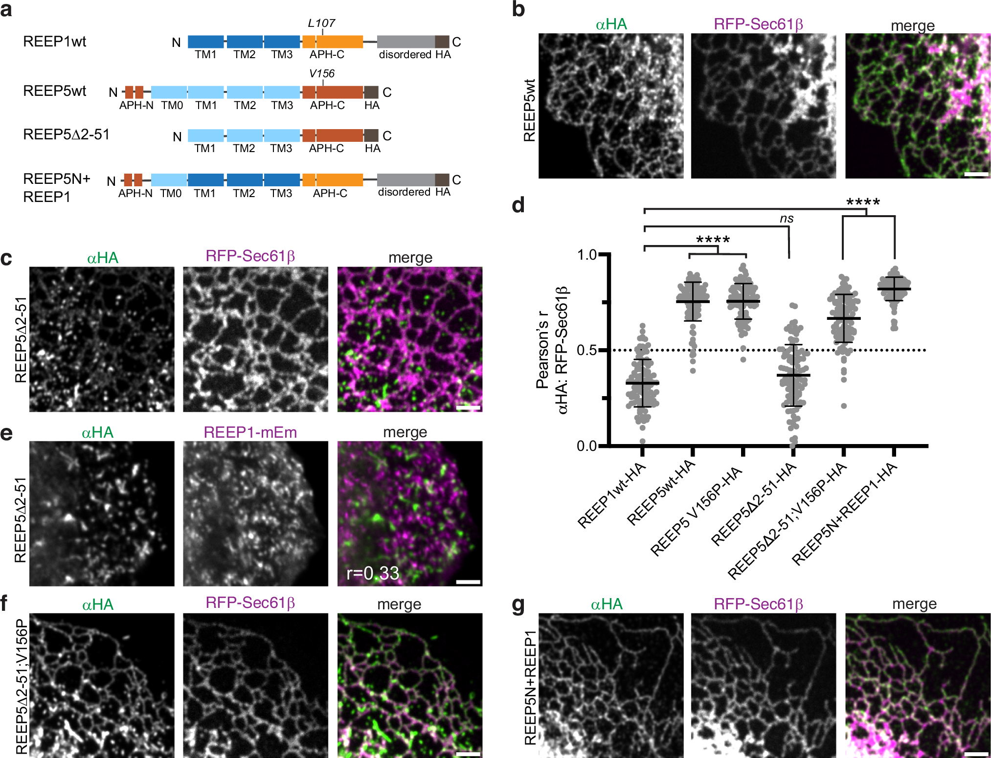 Fig. 3: REEP5’s unique N-terminal domain is important for tubular ER localization.