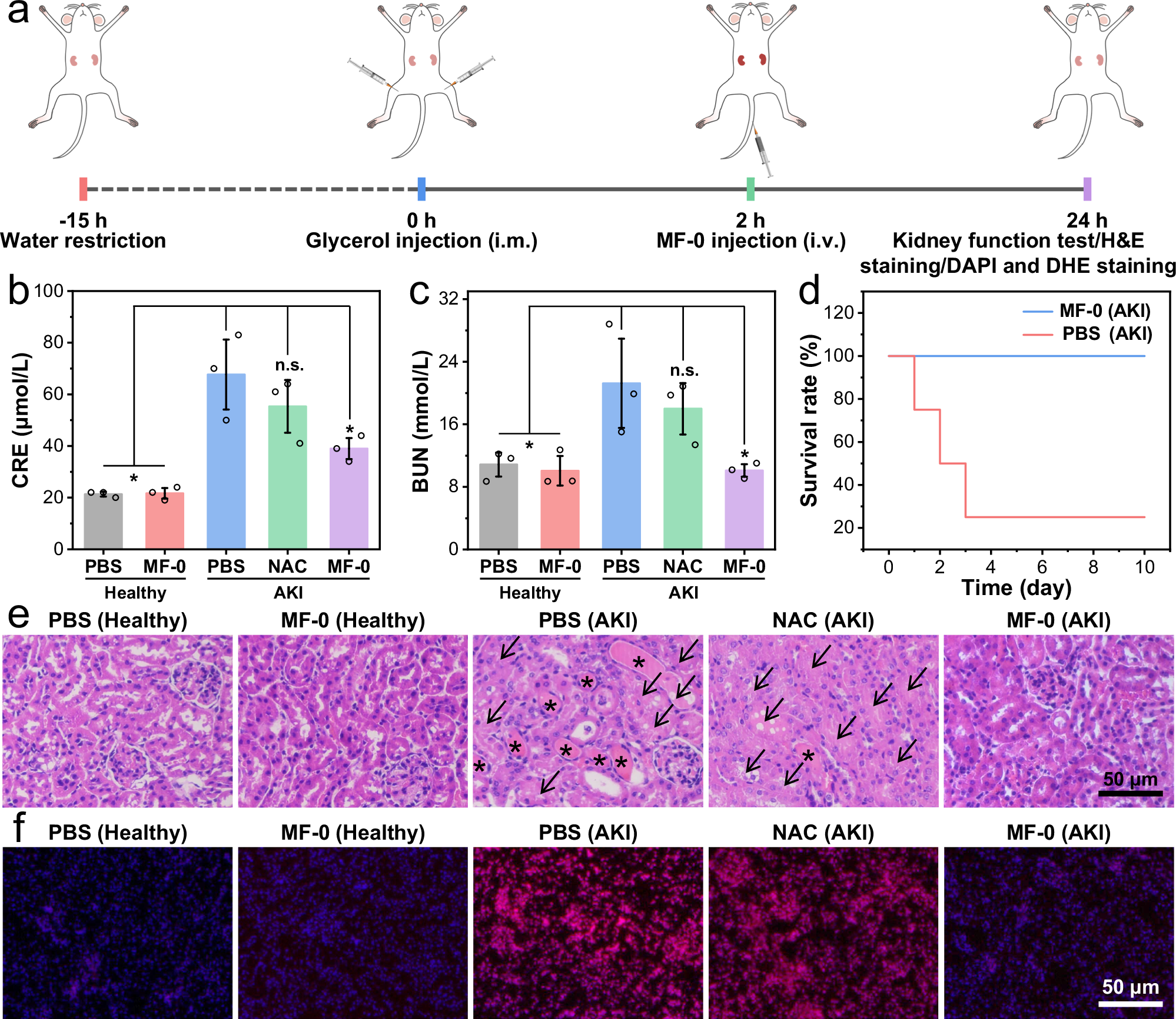 Fig. 5: Schematic diagram of AKI modeling and treatment process, and therapeutic assessments of MF-0 via intravenous injection for AKI.