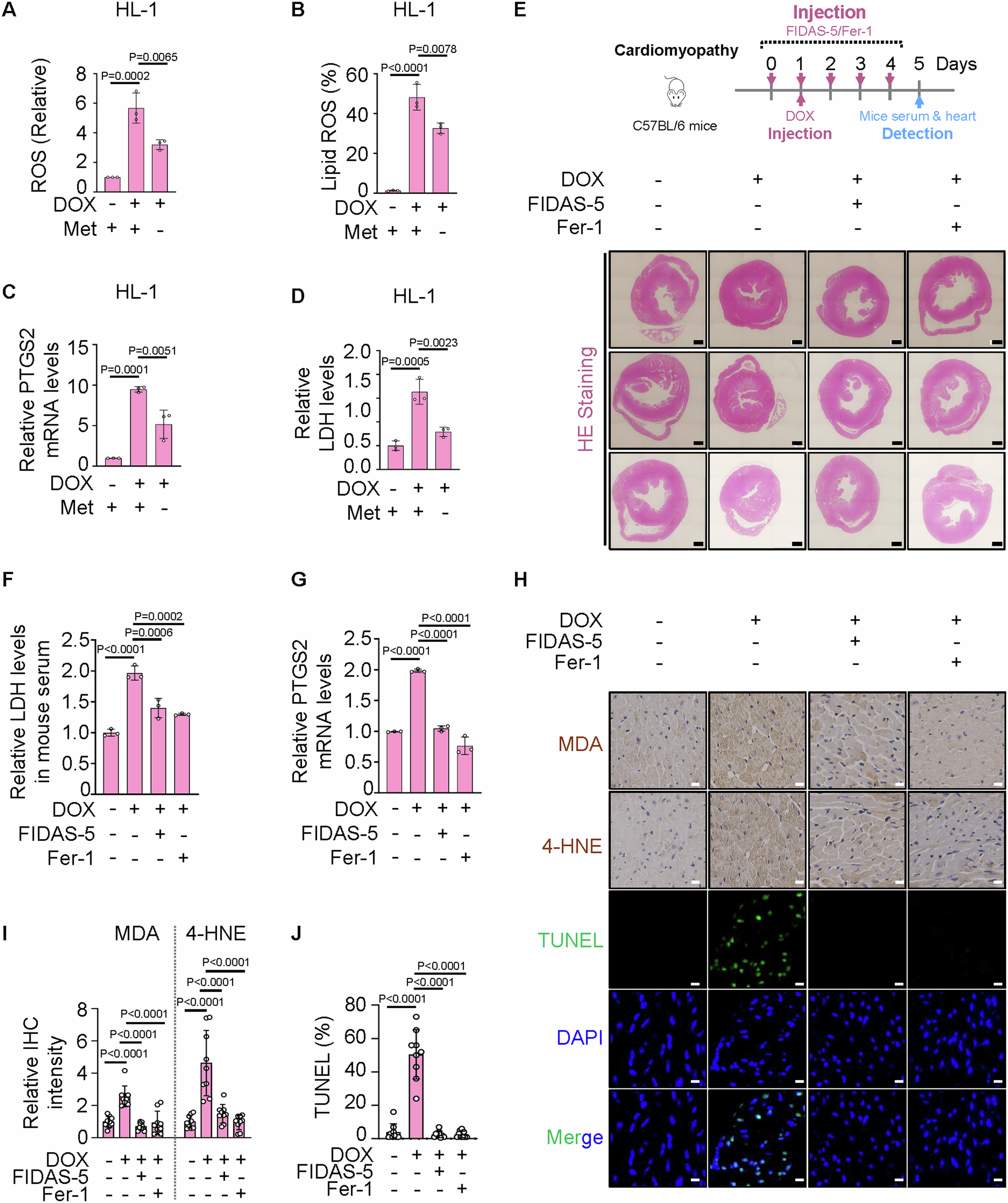 Fig. 7: Inhibition of methionine-SAM metabolic axis alleviates DOX-induced cardiomyopathy.