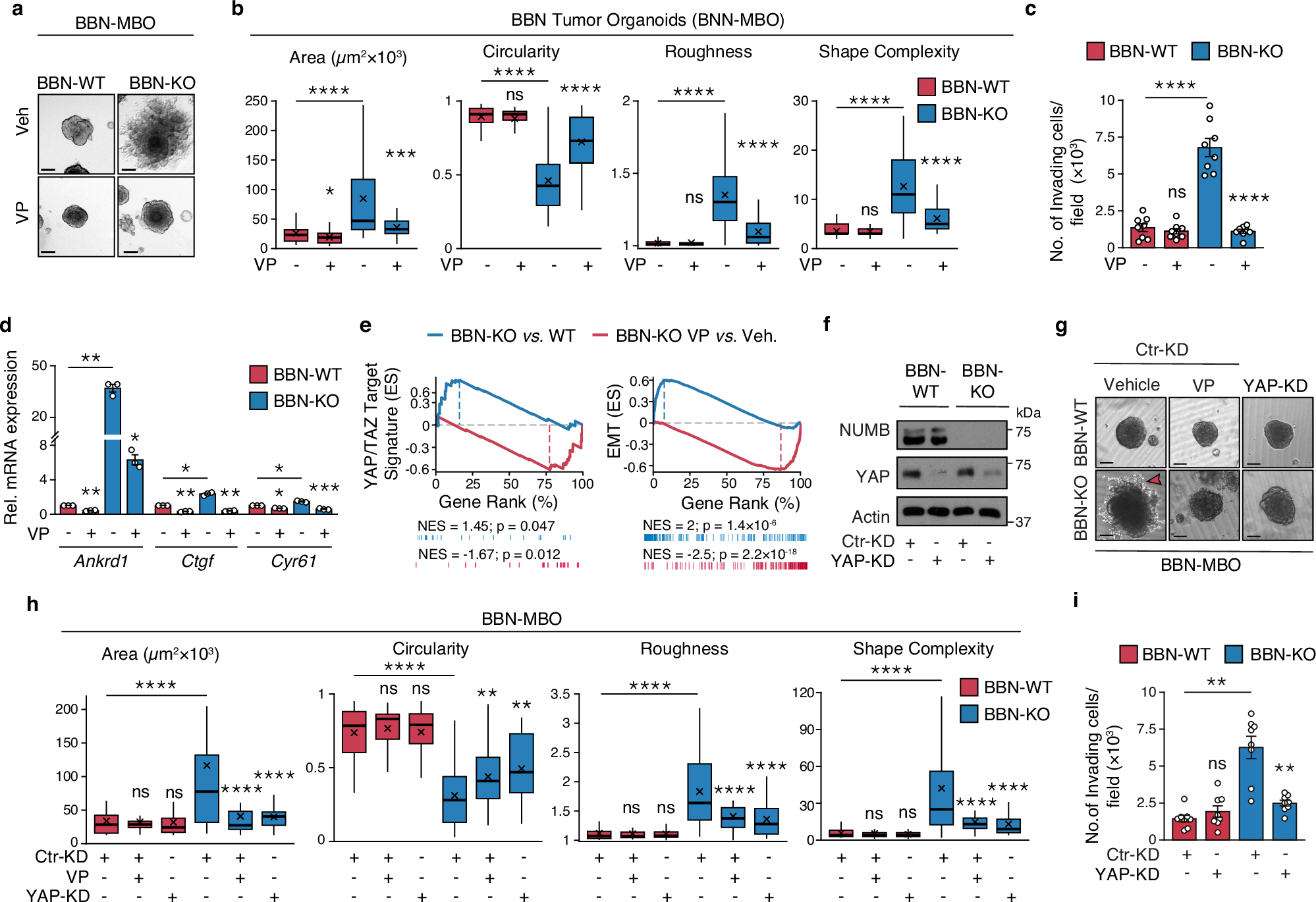 Fig. 5: NUMB loss induces invasive phenotypes and YAP signaling activation in tumor urothelial cells.