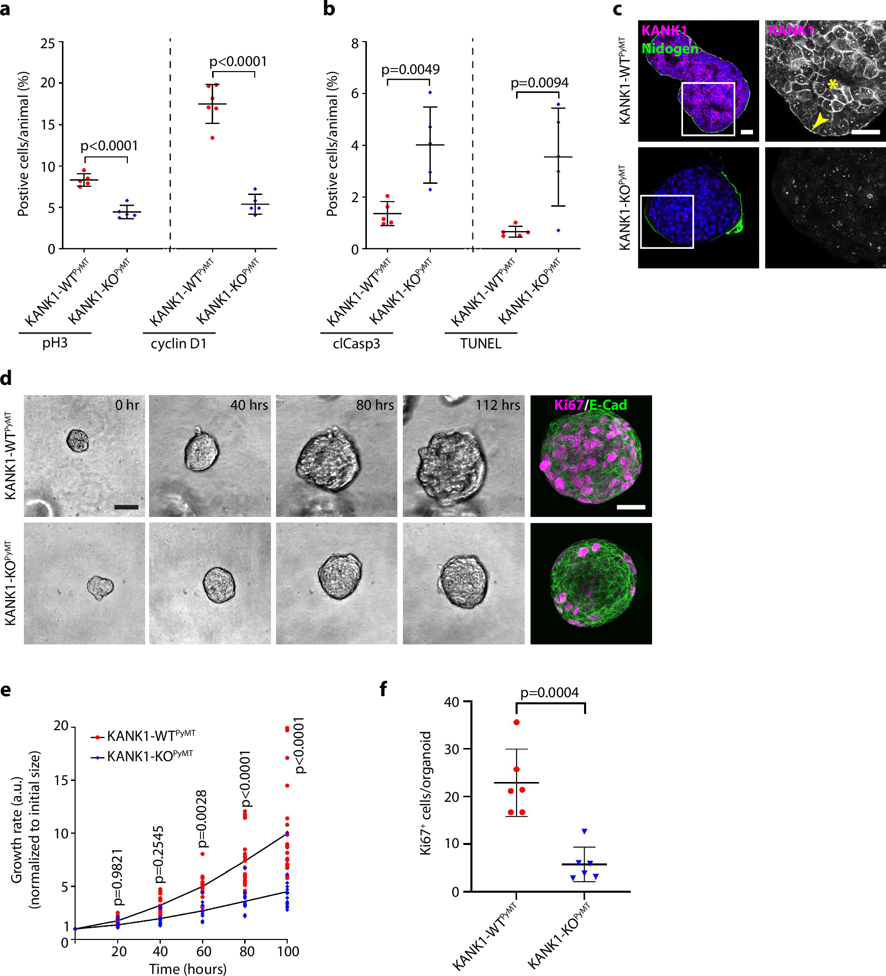 Fig. 3: KANK1 promotes tumor cell proliferation and survival.
