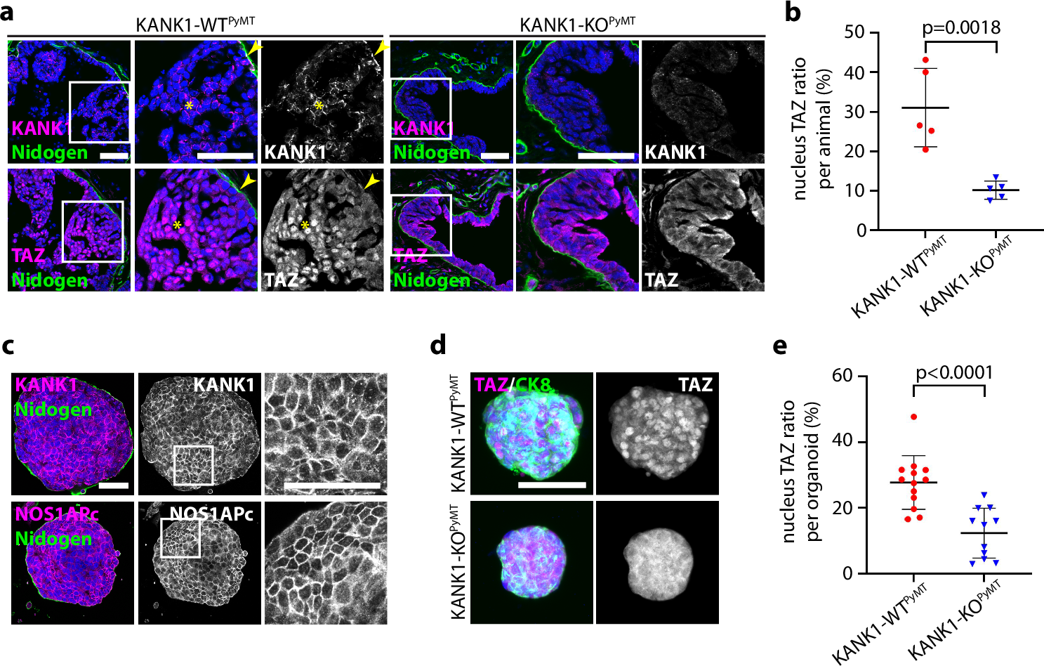 Fig. 9: Junctional translocation of KANK1 promotes nuclear TAZ accumulation in malignant tissues.