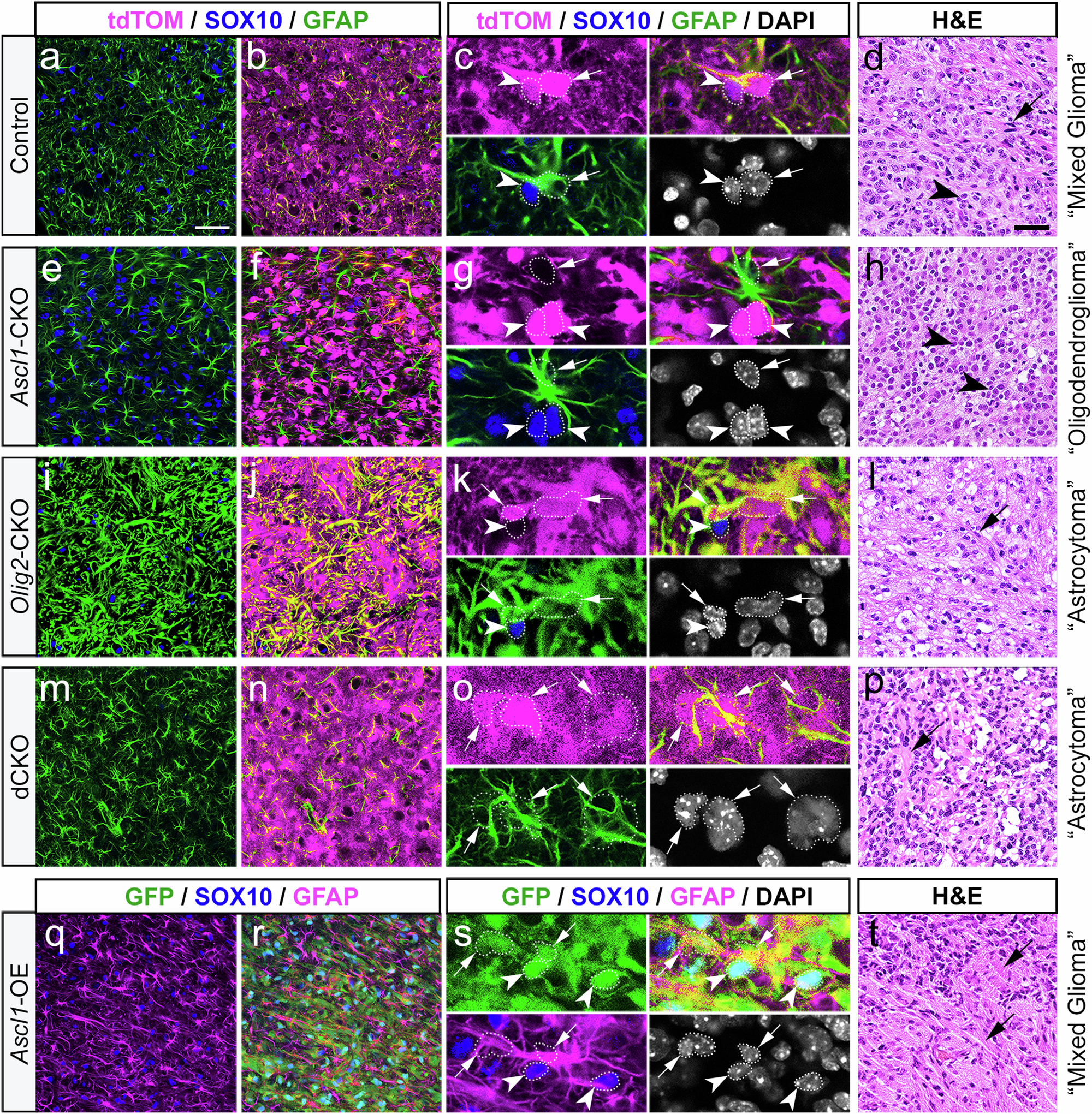 Fig. 4: ASCL1 and OLIG2 inversely regulate glioma tumor cell types.